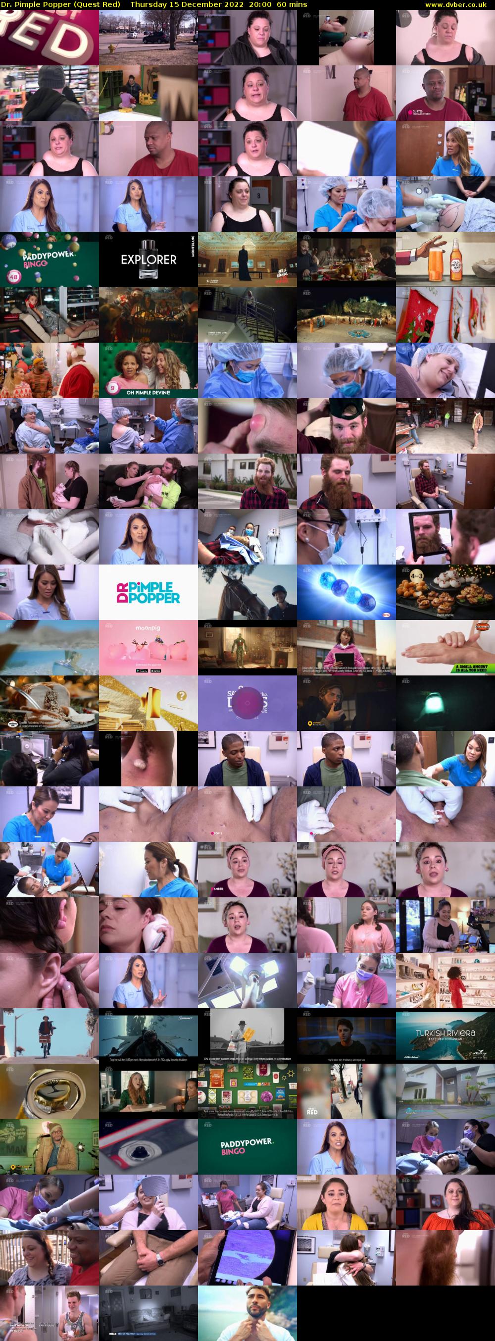 Dr. Pimple Popper (Quest Red) Thursday 15 December 2022 20:00 - 21:00