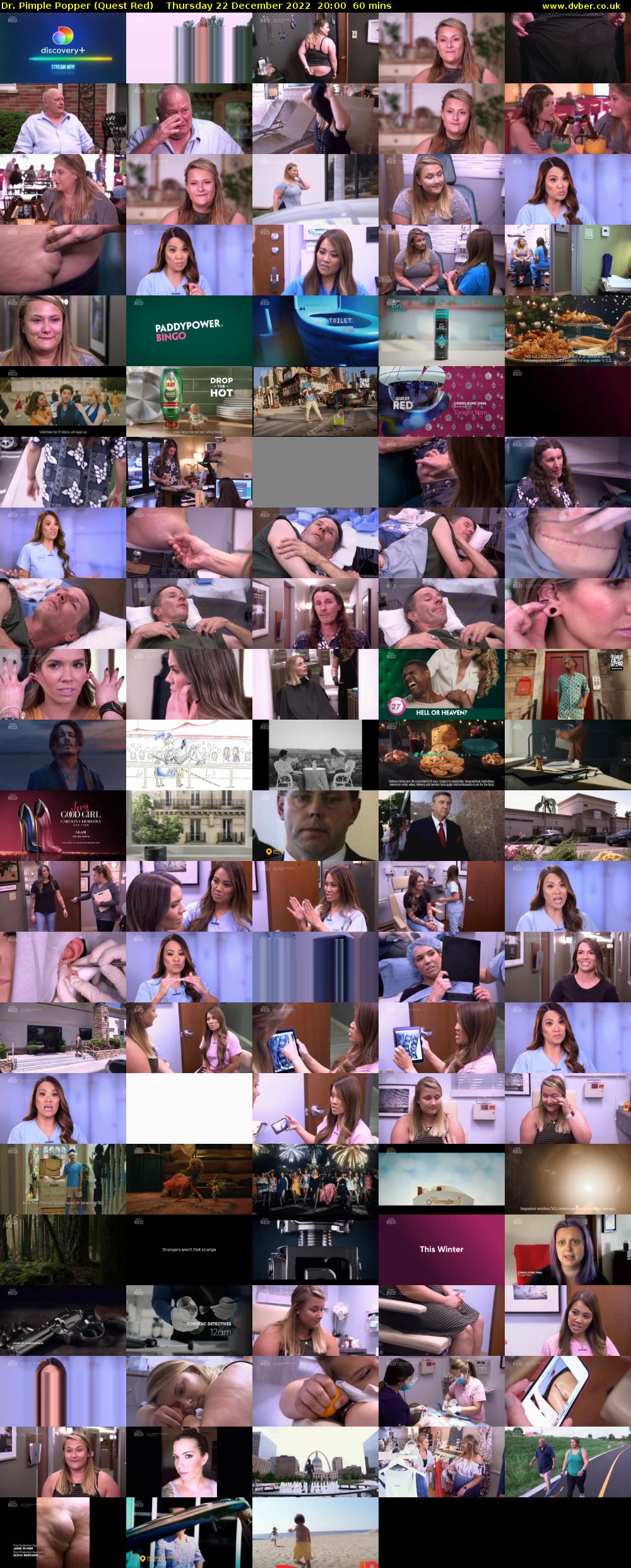 Dr. Pimple Popper (Quest Red) Thursday 22 December 2022 20:00 - 21:00