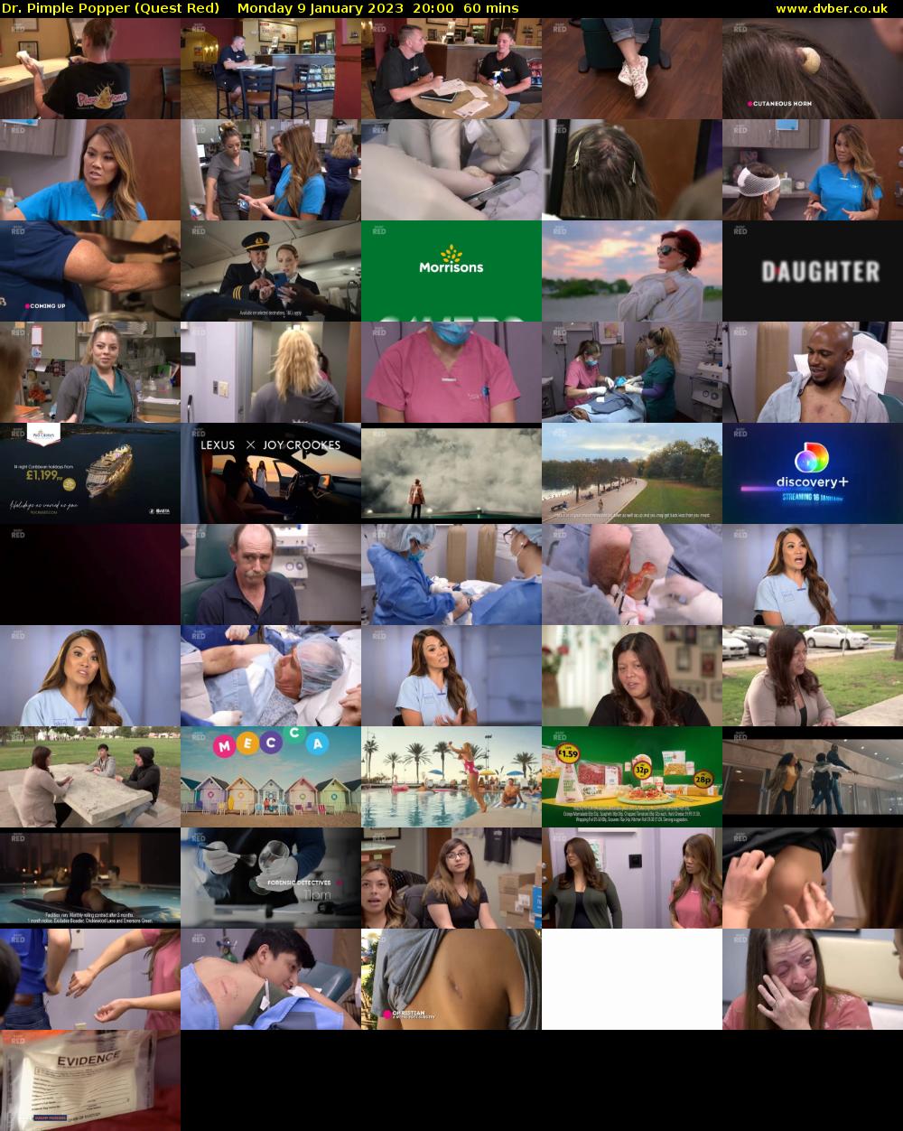 Dr. Pimple Popper (Quest Red) Monday 9 January 2023 20:00 - 21:00