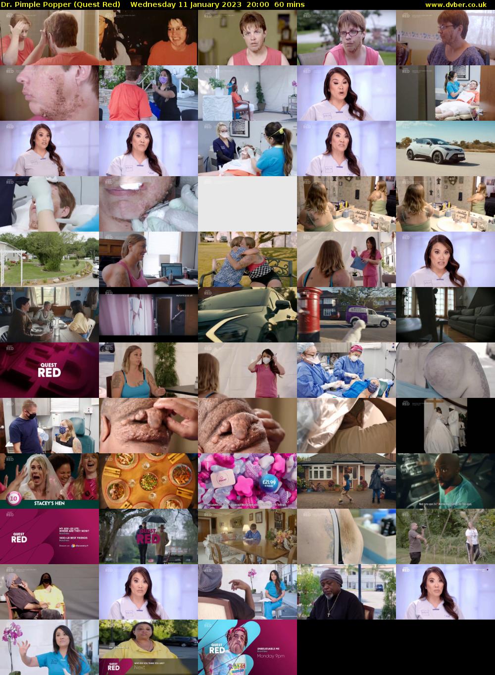 Dr. Pimple Popper (Quest Red) Wednesday 11 January 2023 20:00 - 21:00