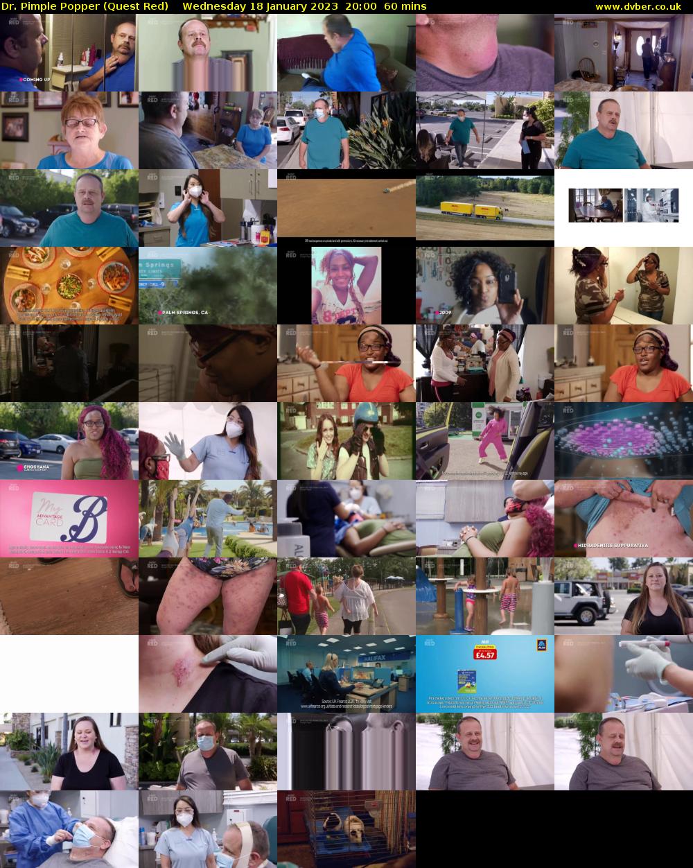 Dr. Pimple Popper (Quest Red) Wednesday 18 January 2023 20:00 - 21:00