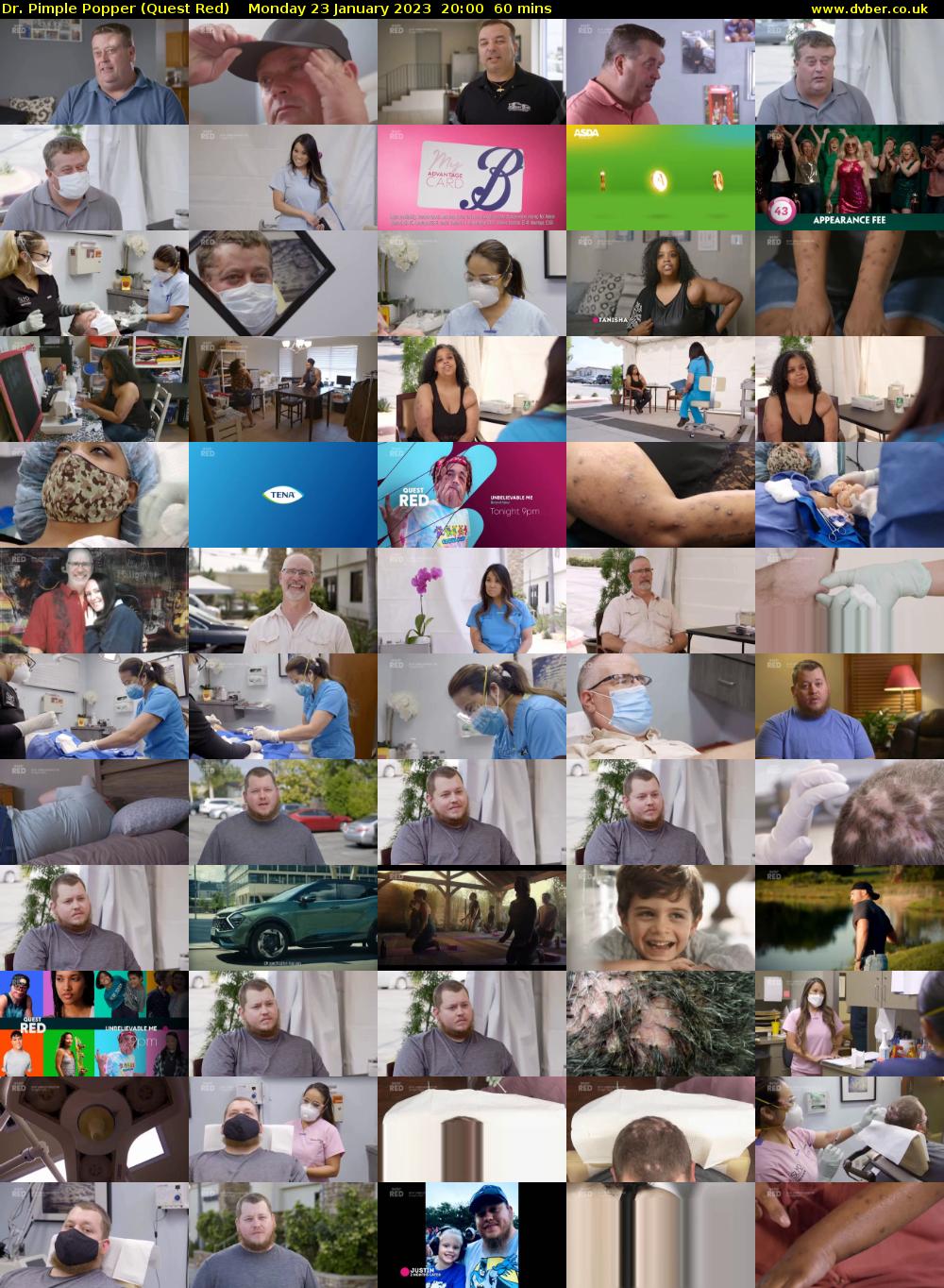 Dr. Pimple Popper (Quest Red) Monday 23 January 2023 20:00 - 21:00