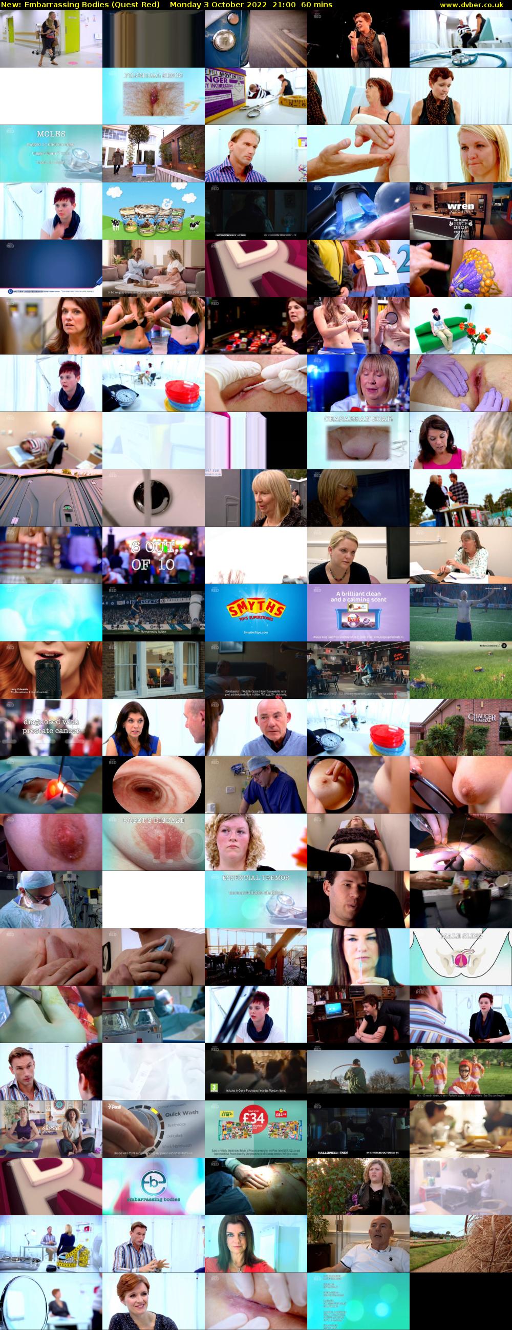 Embarrassing Bodies (Quest Red) Monday 3 October 2022 21:00 - 22:00