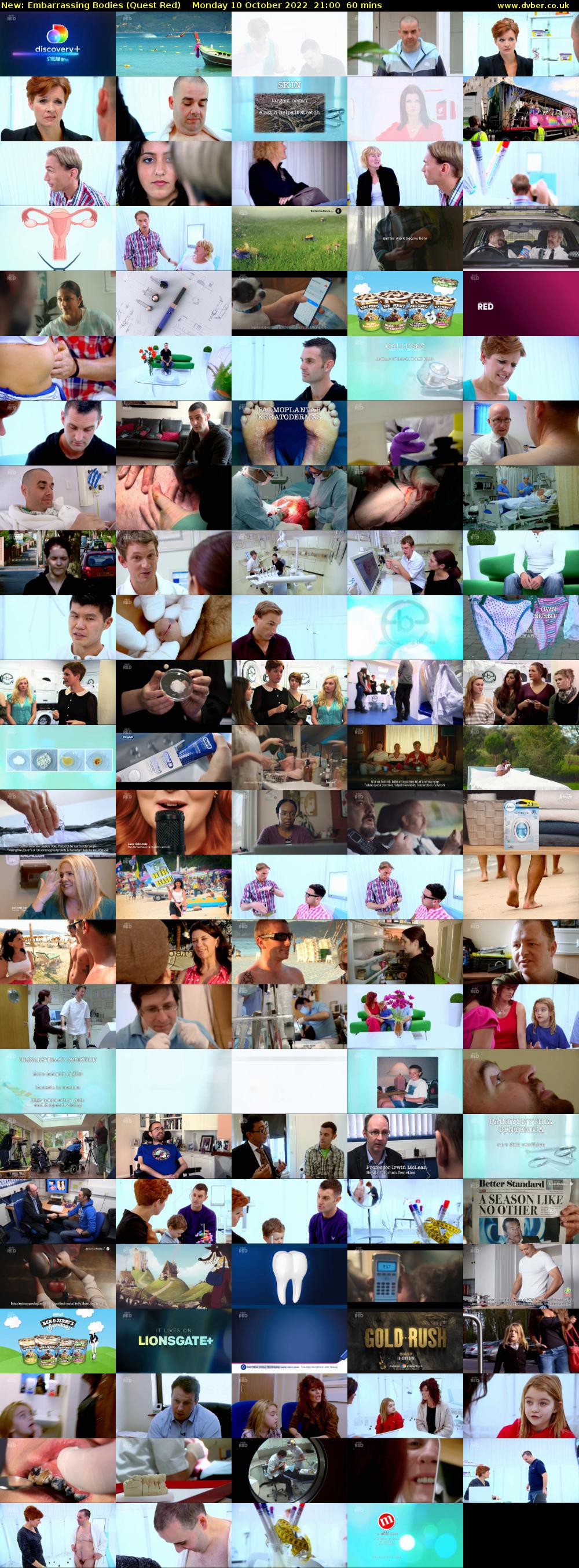 Embarrassing Bodies (Quest Red) Monday 10 October 2022 21:00 - 22:00