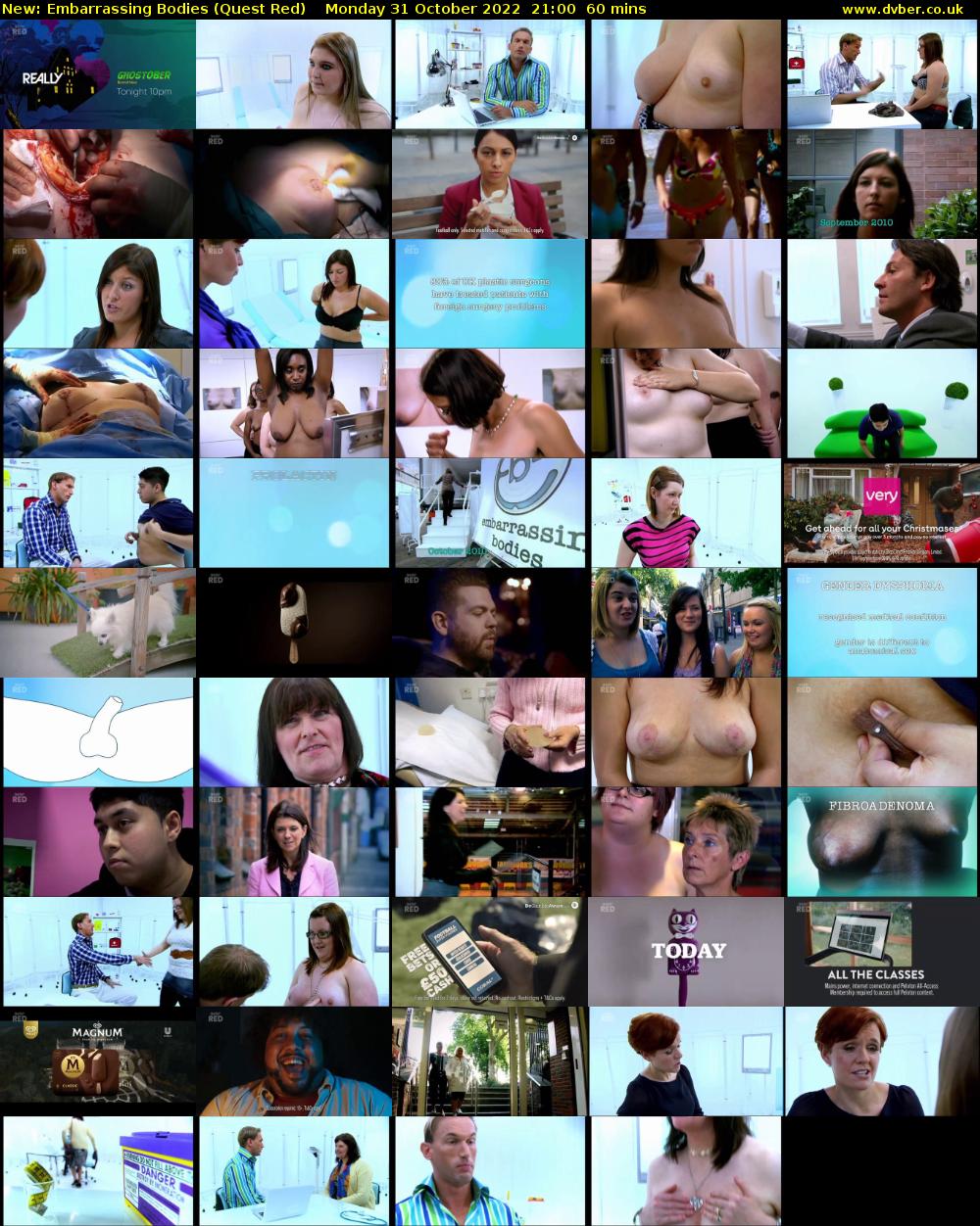 Embarrassing Bodies (Quest Red) Monday 31 October 2022 21:00 - 22:00