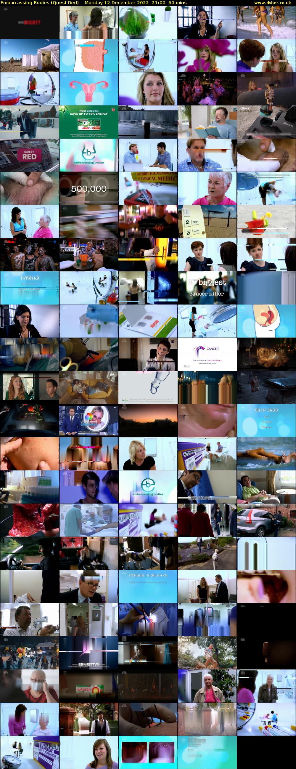 Embarrassing Bodies (Quest Red) Monday 12 December 2022 21:00 - 22:00