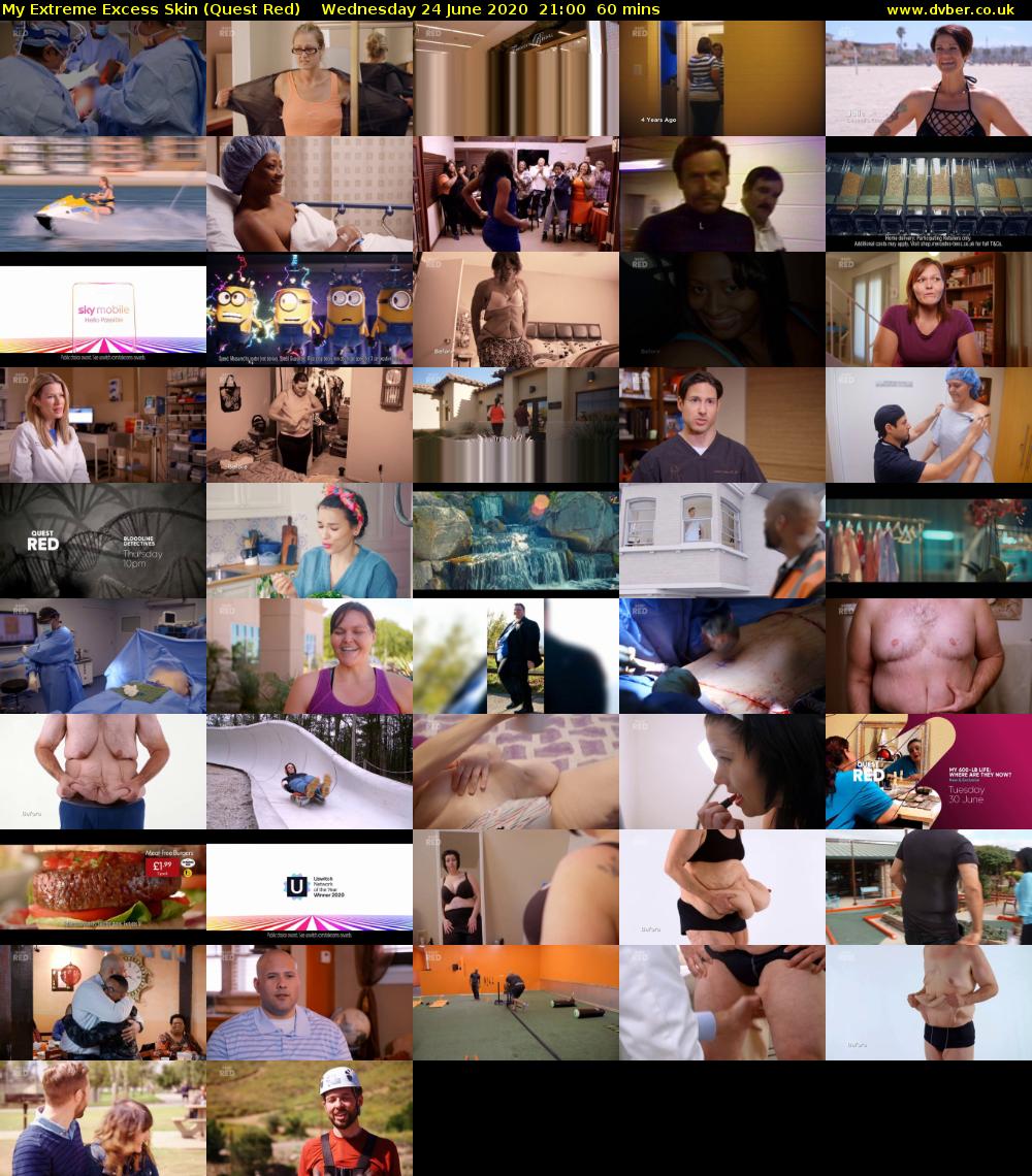 My Extreme Excess Skin (Quest Red) Wednesday 24 June 2020 21:00 - 22:00