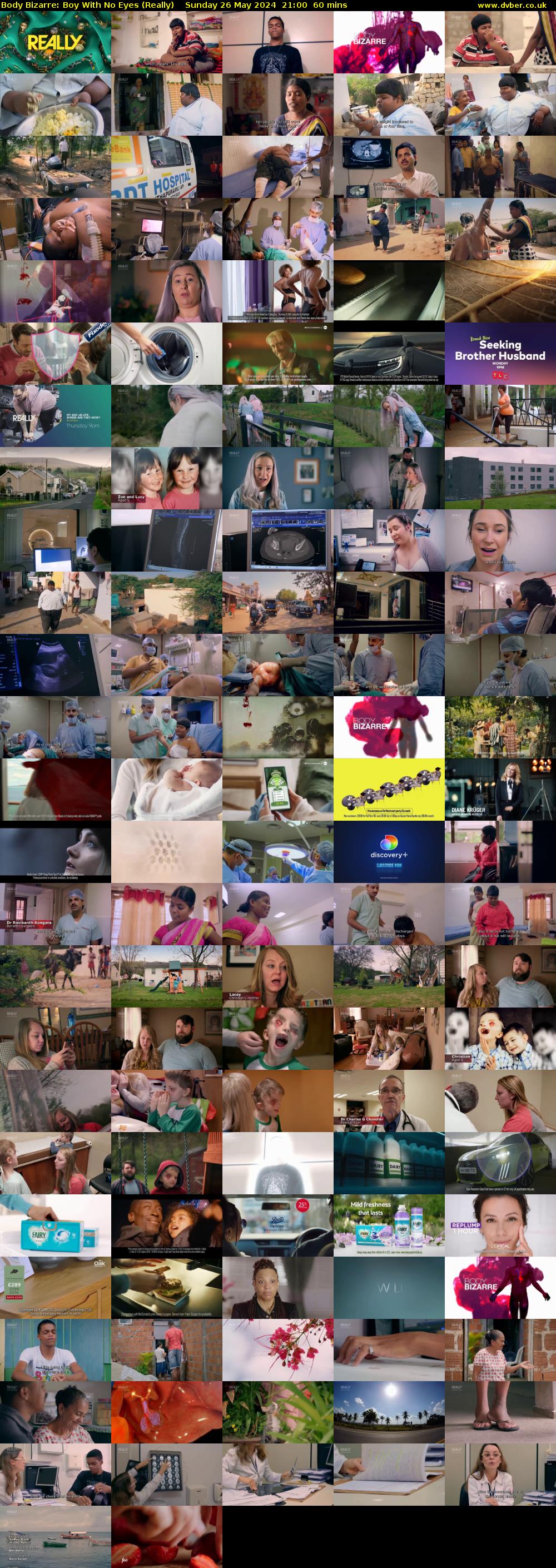 Body Bizarre: Boy With No Eyes (Really) Sunday 26 May 2024 21:00 - 22:00