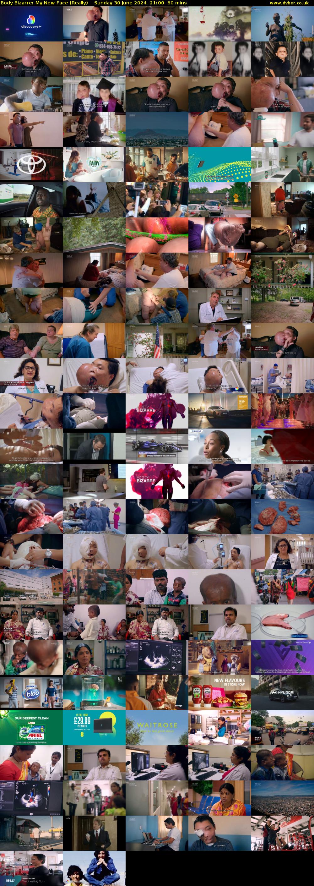 Body Bizarre: My New Face (Really) Sunday 30 June 2024 21:00 - 22:00