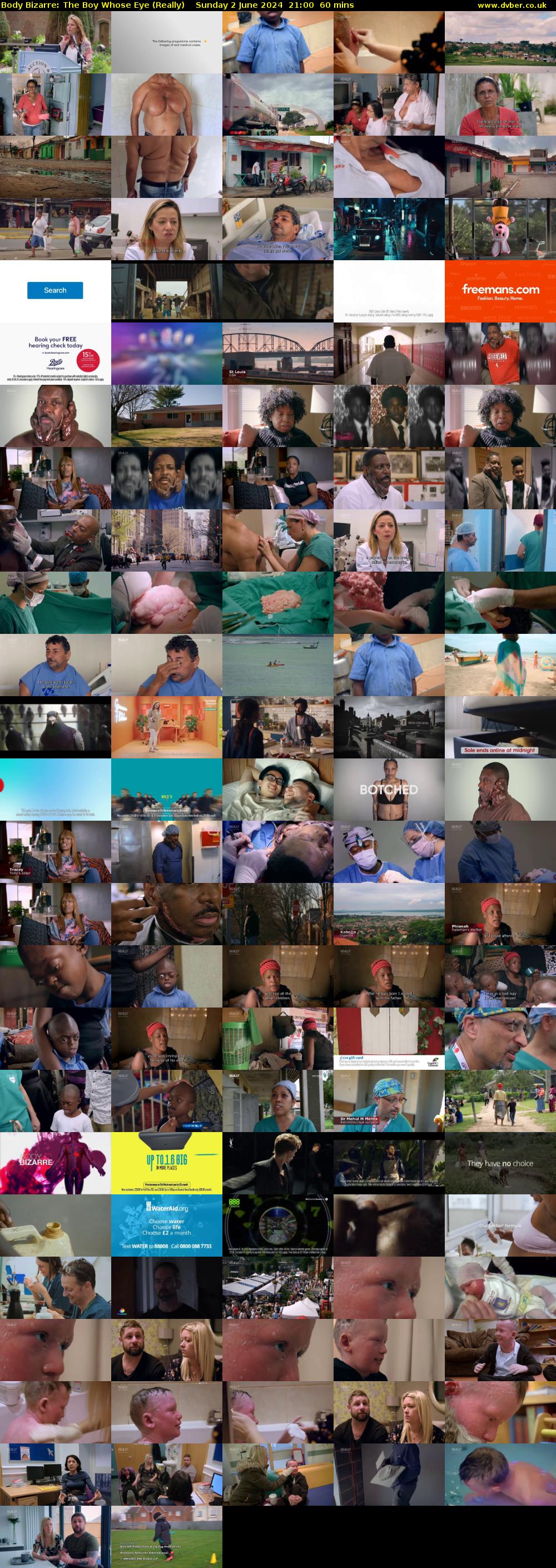 Body Bizarre: The Boy Whose Eye (Really) Sunday 2 June 2024 21:00 - 22:00