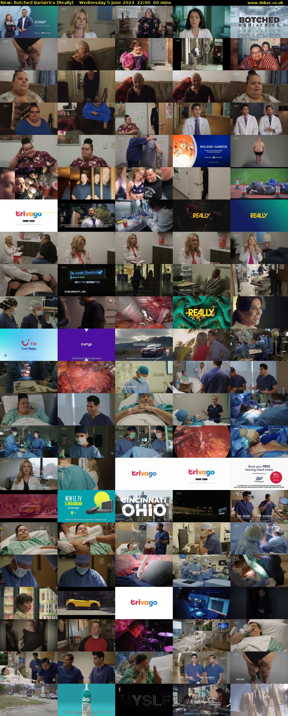 Botched Bariatrics (Really) Wednesday 5 June 2024 22:00 - 23:00