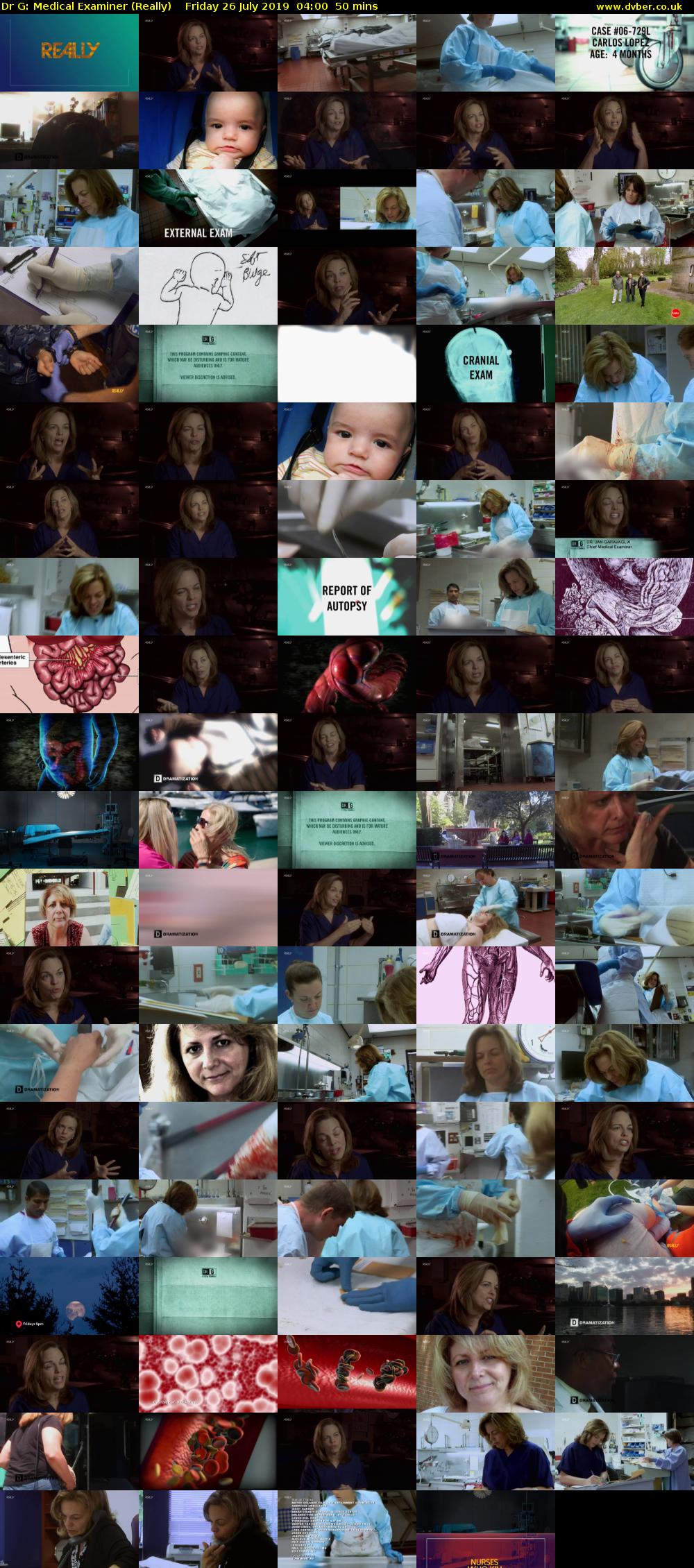 Dr G: Medical Examiner (Really) Friday 26 July 2019 04:00 - 04:50