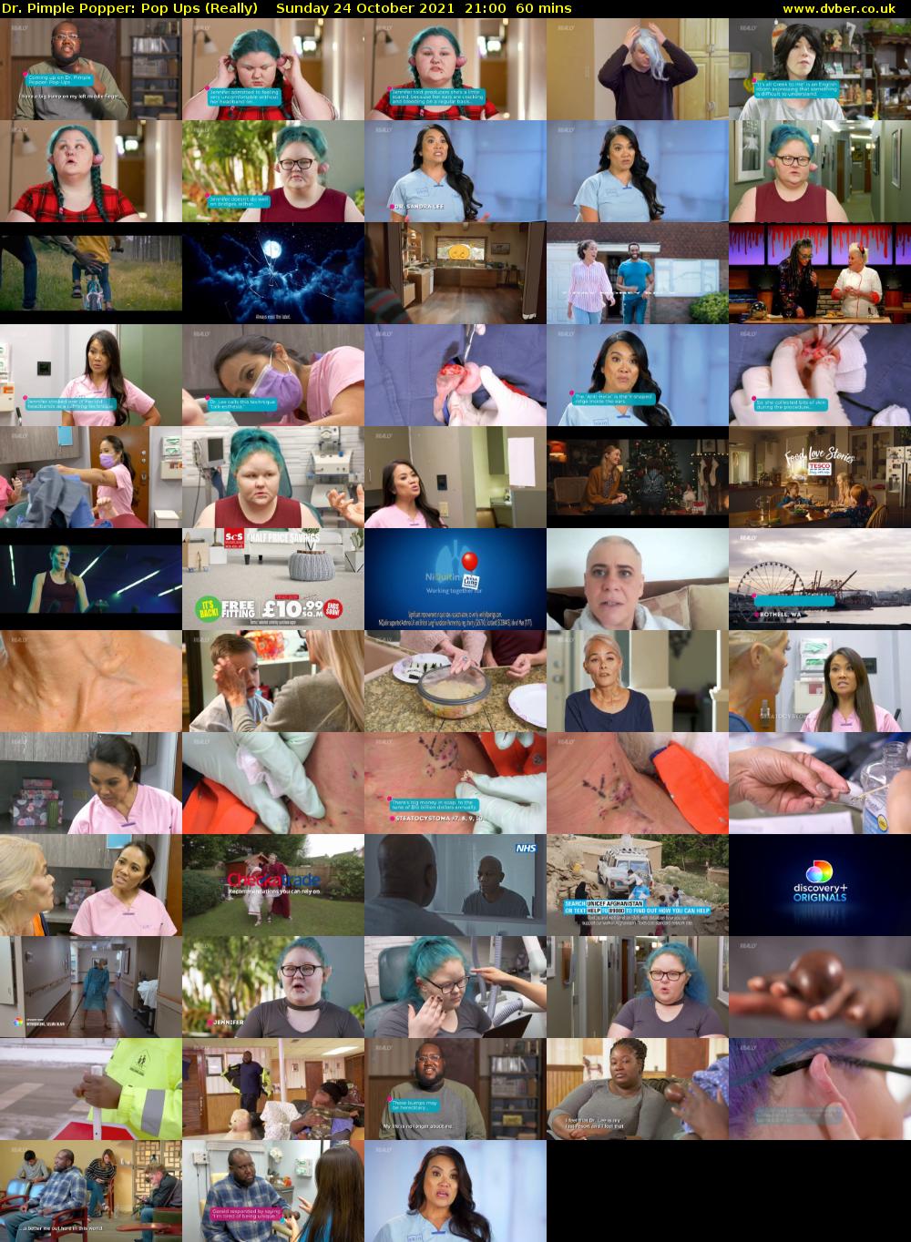 Dr. Pimple Popper: Pop Ups (Really) Sunday 24 October 2021 21:00 - 22:00