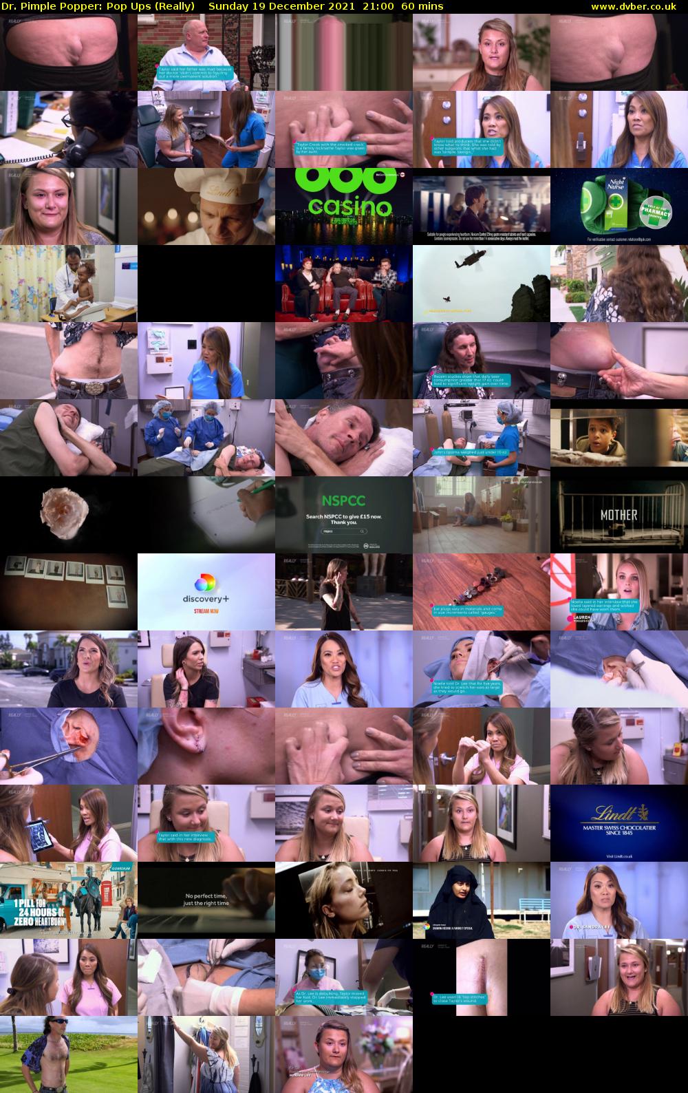 Dr. Pimple Popper: Pop Ups (Really) Sunday 19 December 2021 21:00 - 22:00