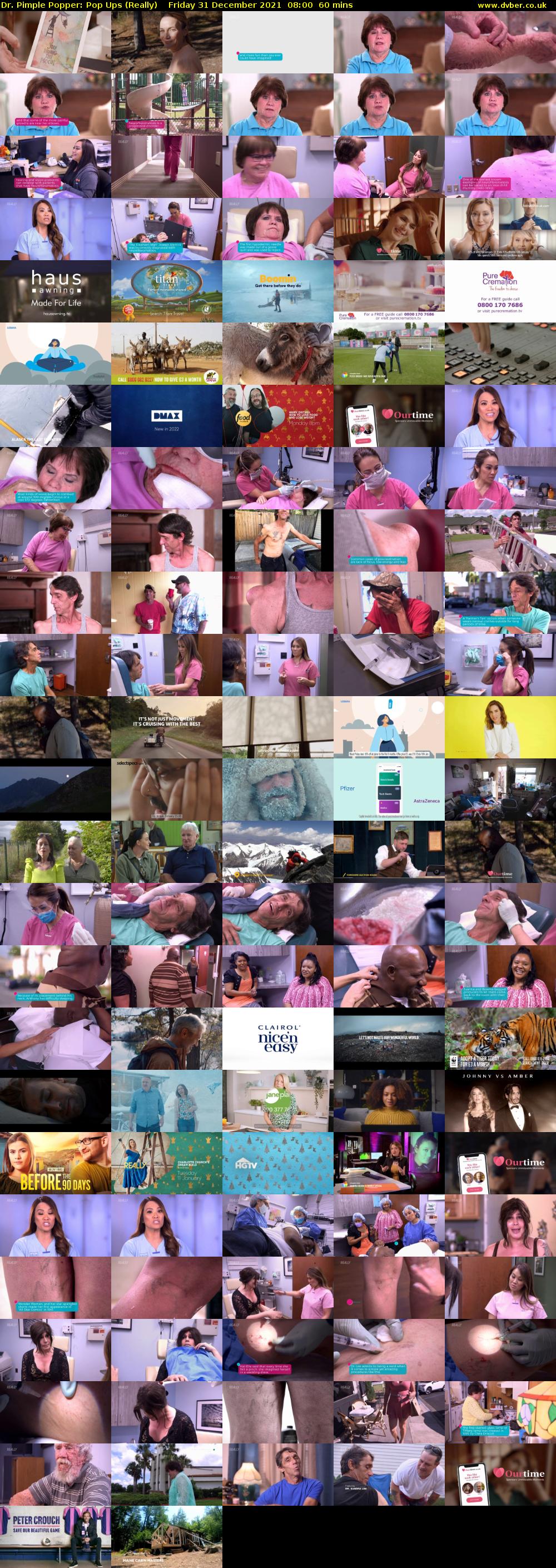 Dr. Pimple Popper: Pop Ups (Really) Friday 31 December 2021 08:00 - 09:00
