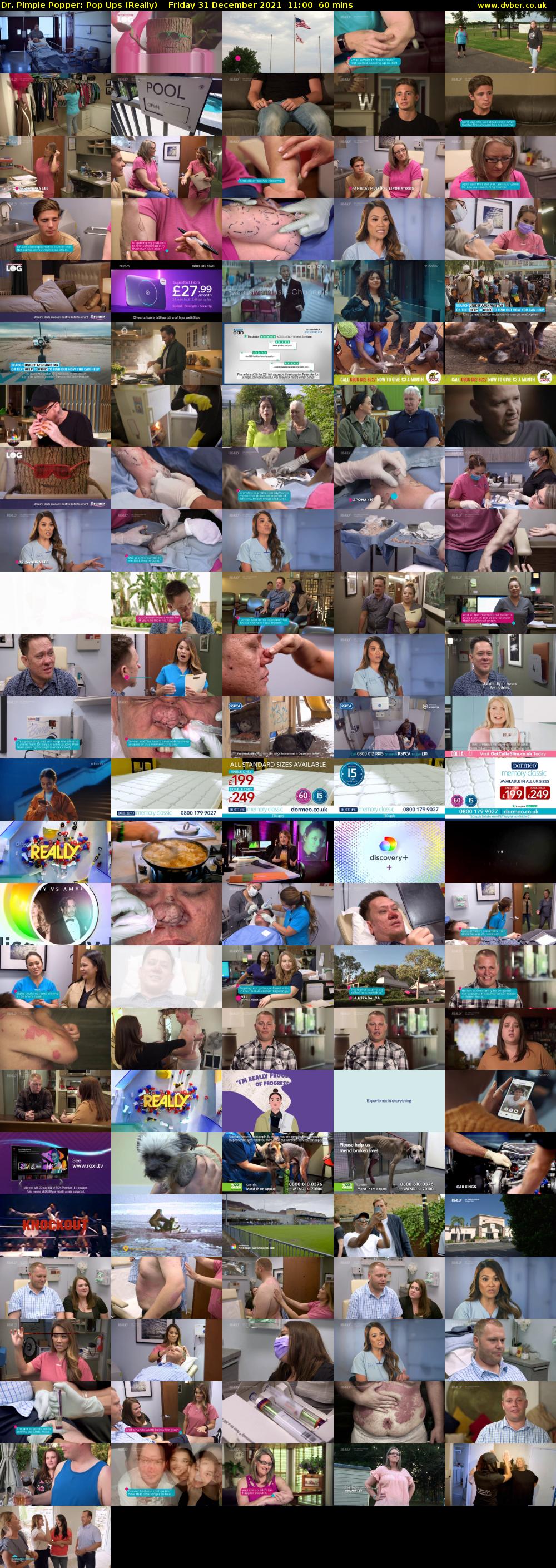 Dr. Pimple Popper: Pop Ups (Really) Friday 31 December 2021 11:00 - 12:00