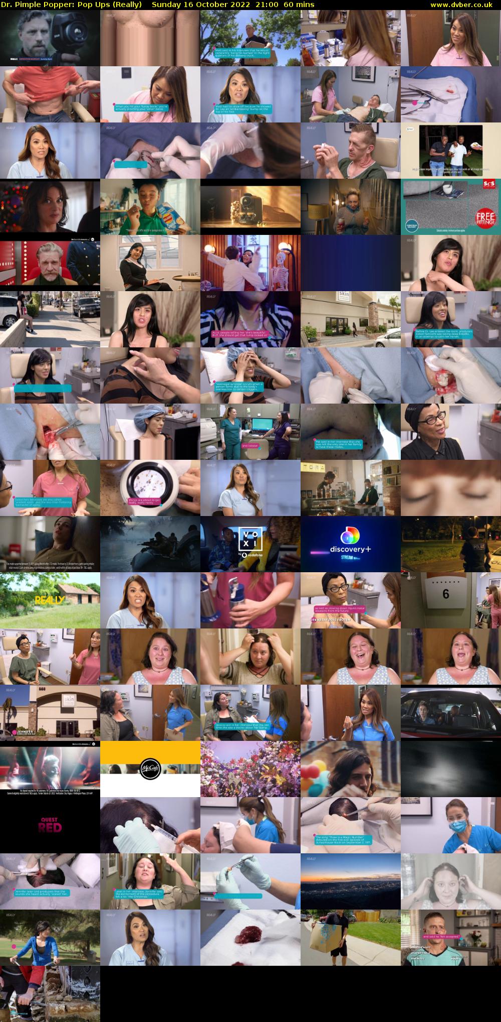Dr. Pimple Popper: Pop Ups (Really) Sunday 16 October 2022 21:00 - 22:00