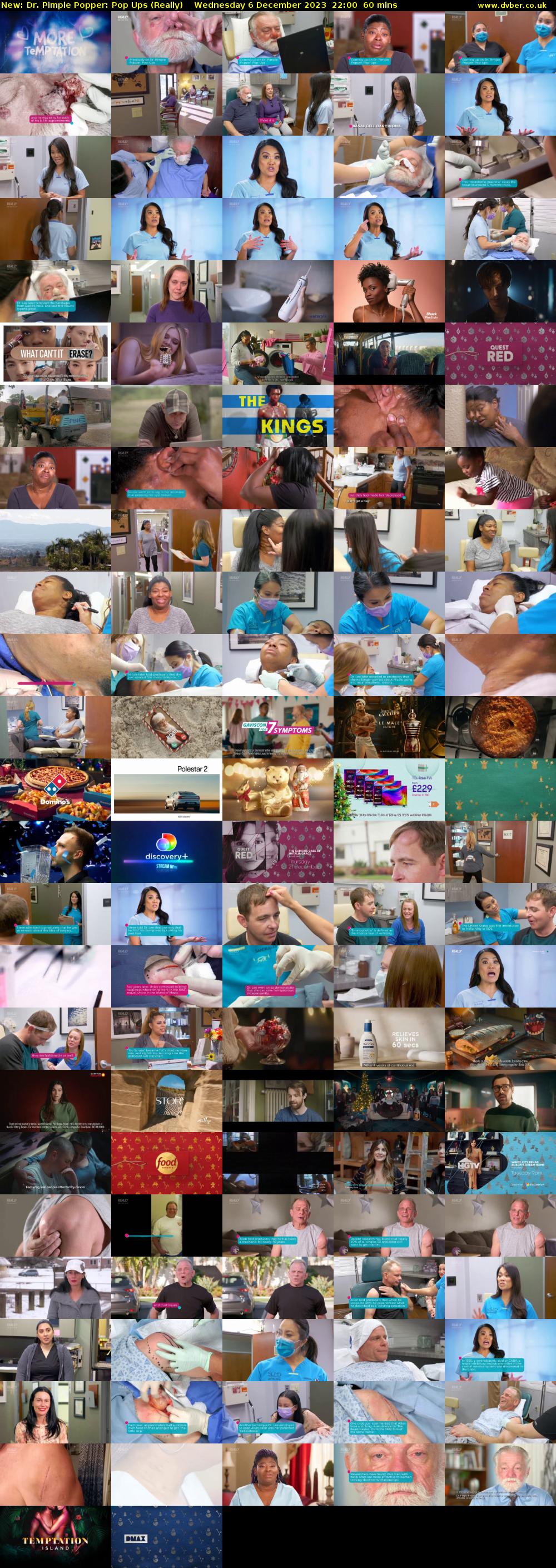 Dr. Pimple Popper: Pop Ups (Really) Wednesday 6 December 2023 22:00 - 23:00