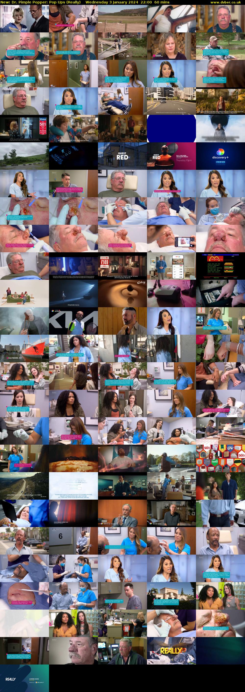 Dr. Pimple Popper: Pop Ups (Really) Wednesday 3 January 2024 22:00 - 23:00