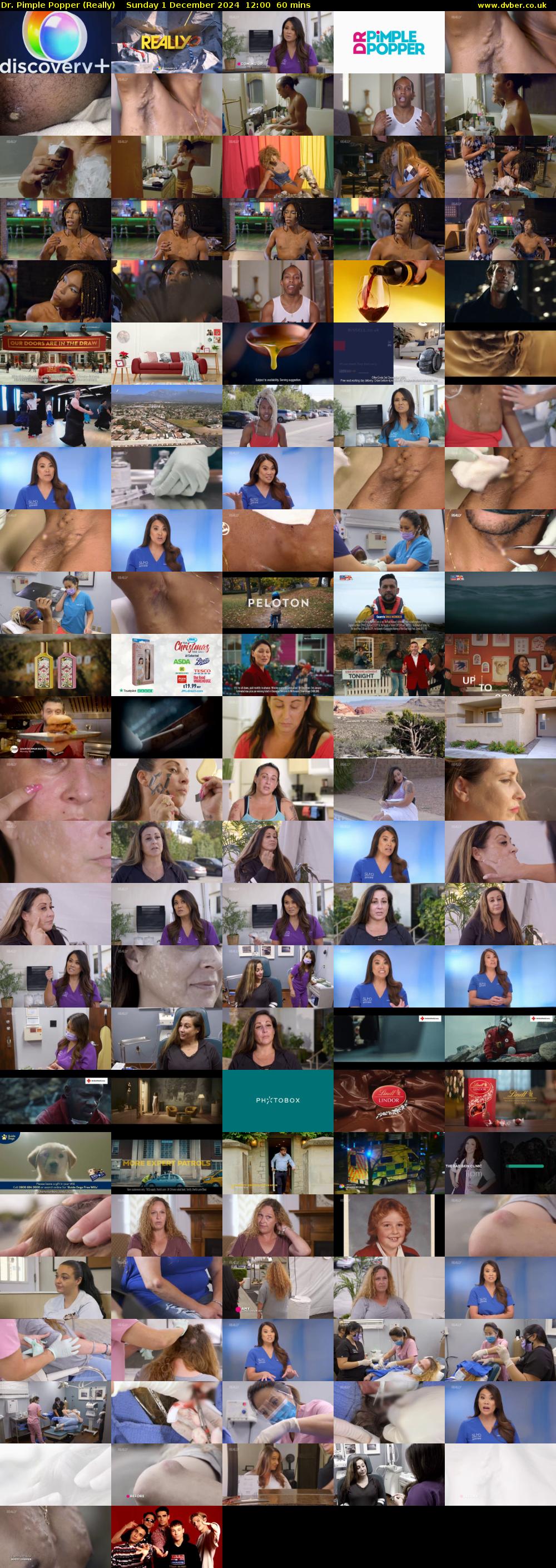 Dr. Pimple Popper (Really) Sunday 1 December 2024 12:00 - 13:00