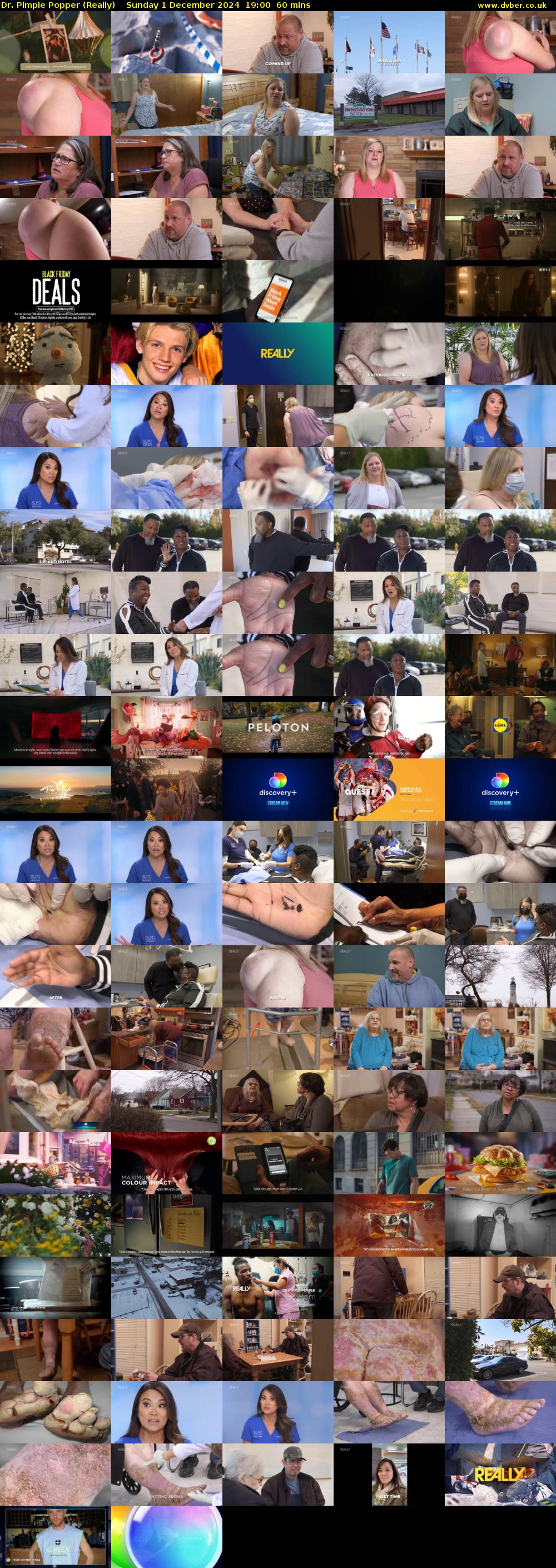 Dr. Pimple Popper (Really) Sunday 1 December 2024 19:00 - 20:00