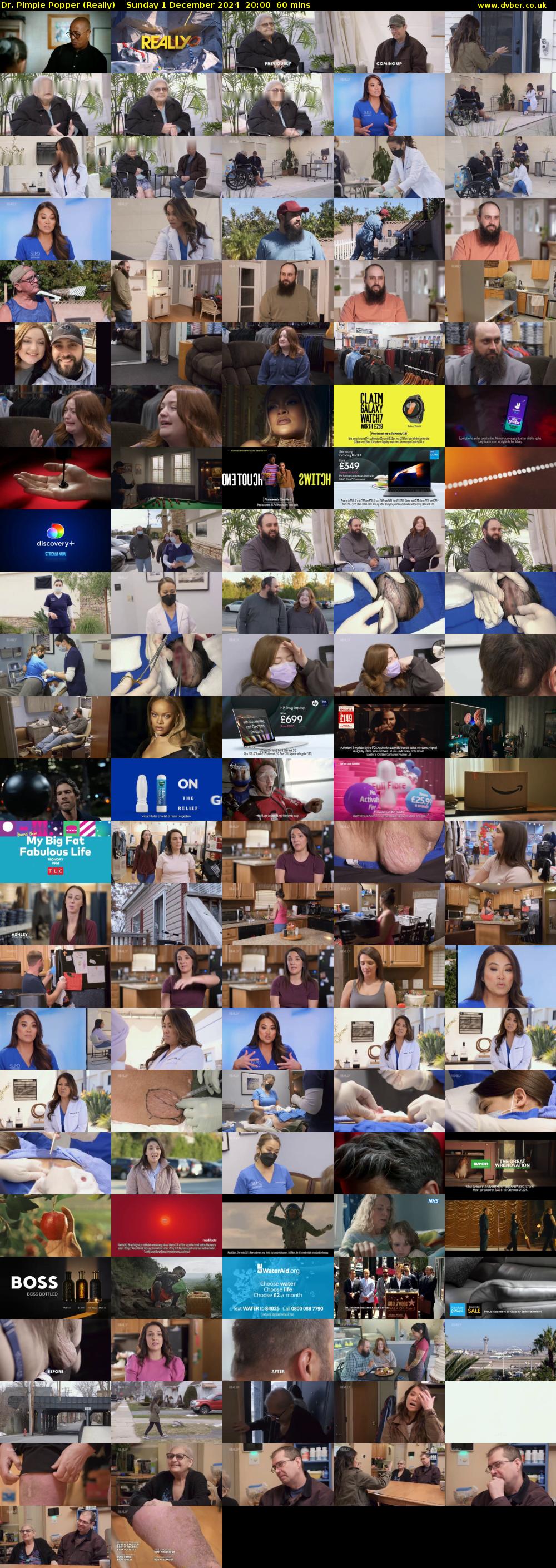 Dr. Pimple Popper (Really) Sunday 1 December 2024 20:00 - 21:00