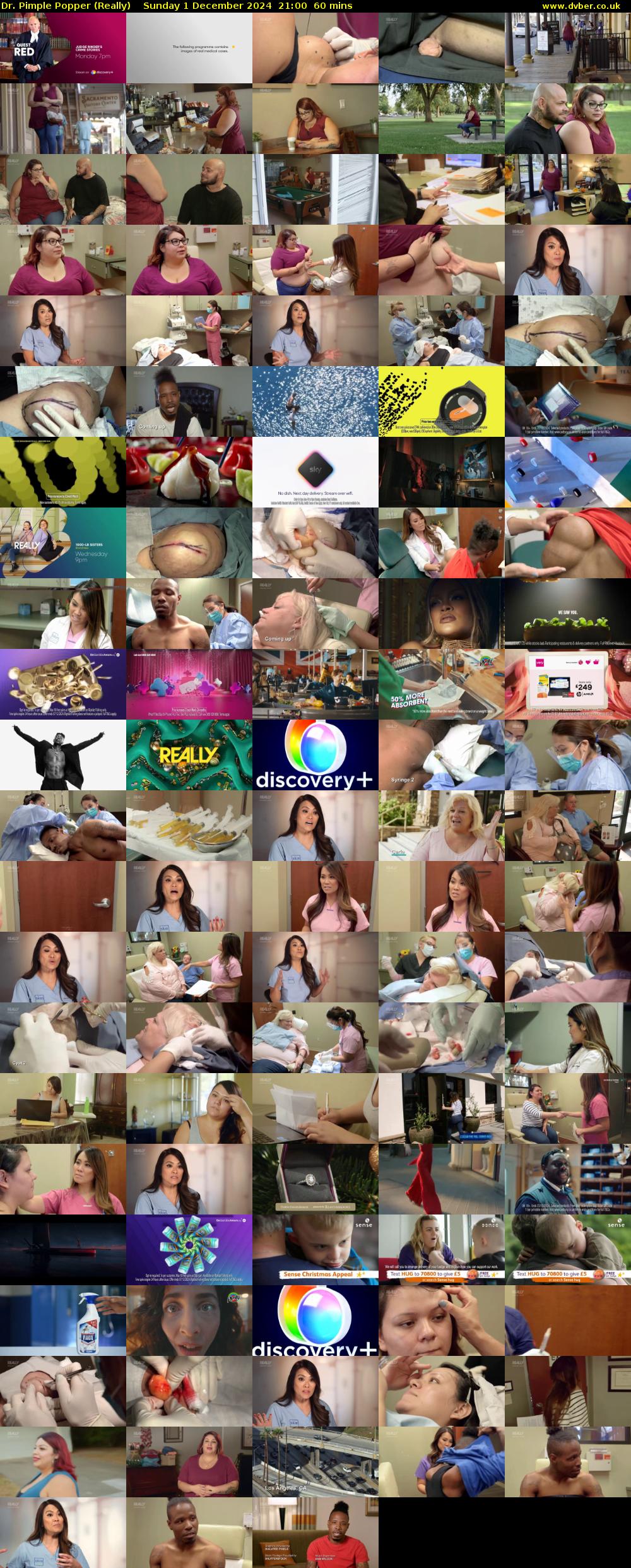 Dr. Pimple Popper (Really) Sunday 1 December 2024 21:00 - 22:00