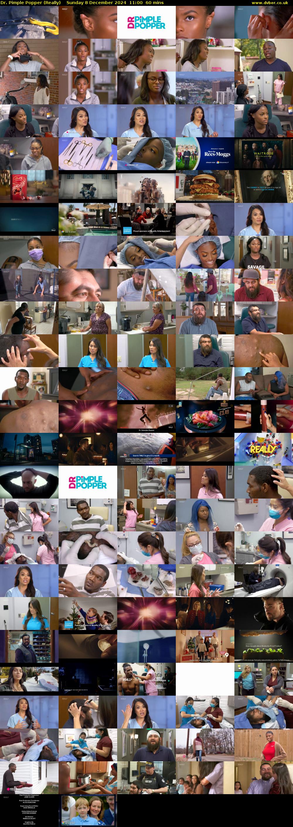 Dr. Pimple Popper (Really) Sunday 8 December 2024 11:00 - 12:00