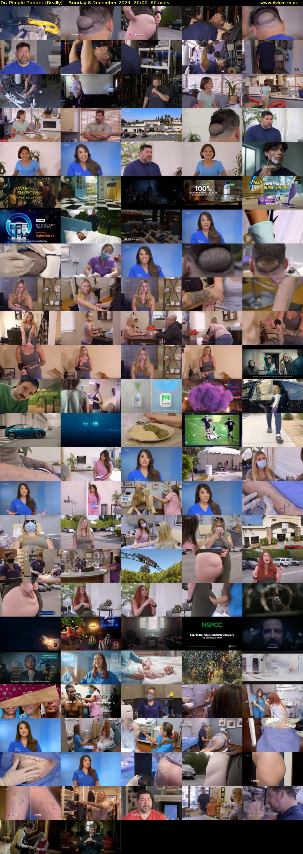 Dr. Pimple Popper (Really) Sunday 8 December 2024 20:00 - 21:00