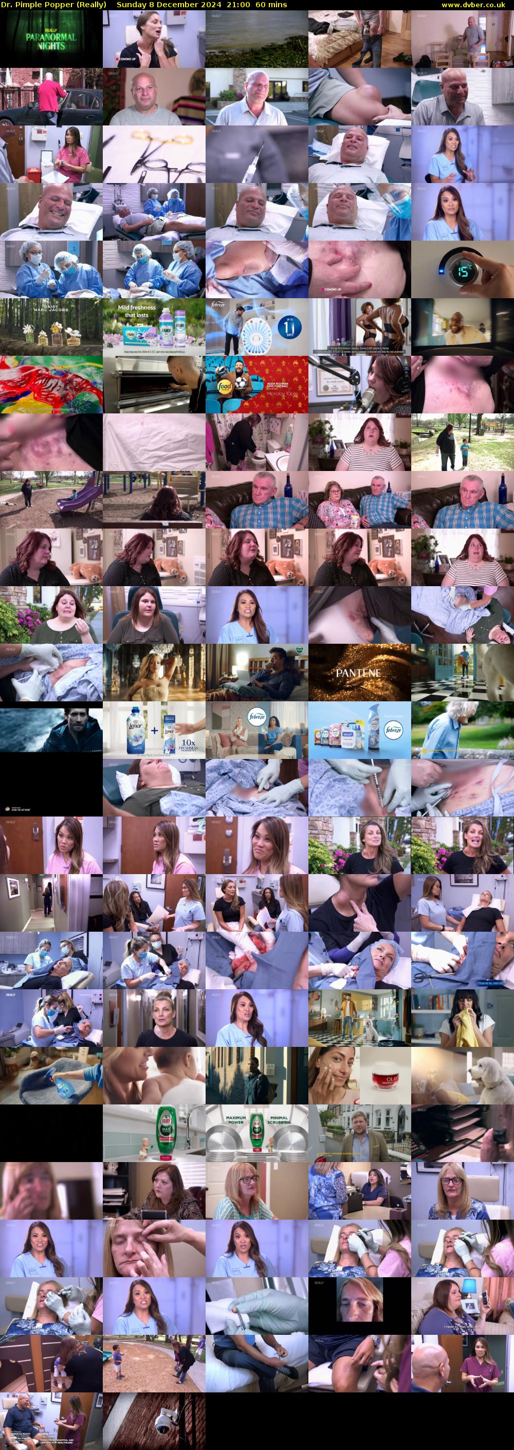 Dr. Pimple Popper (Really) Sunday 8 December 2024 21:00 - 22:00