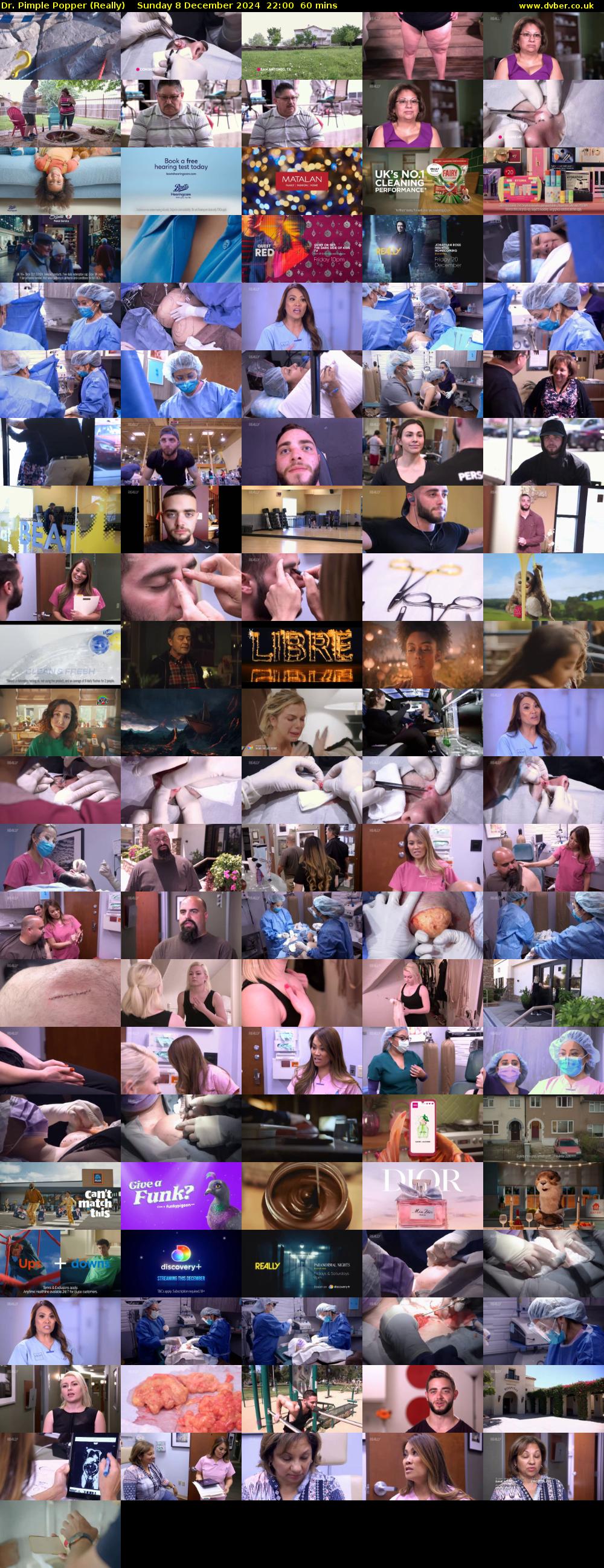 Dr. Pimple Popper (Really) Sunday 8 December 2024 22:00 - 23:00
