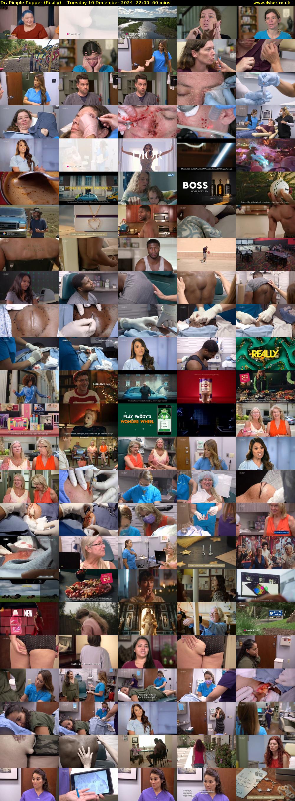 Dr. Pimple Popper (Really) Tuesday 10 December 2024 22:00 - 23:00