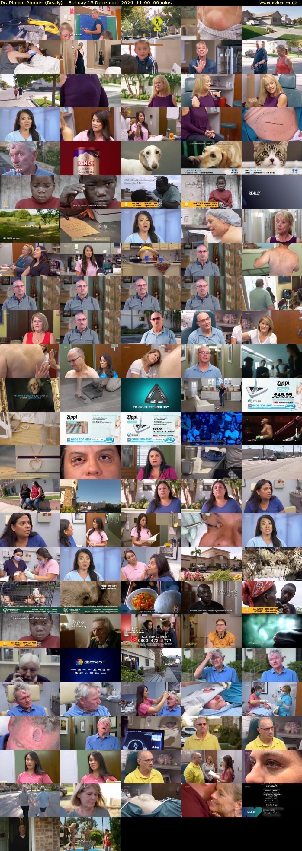 Dr. Pimple Popper (Really) Sunday 15 December 2024 11:00 - 12:00