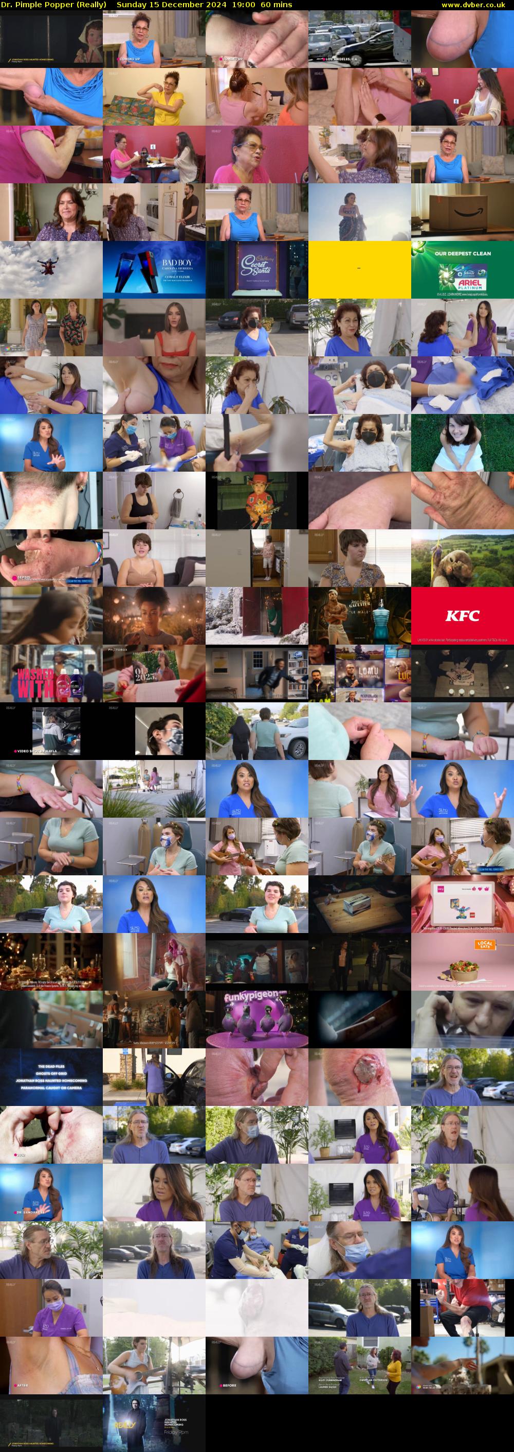 Dr. Pimple Popper (Really) Sunday 15 December 2024 19:00 - 20:00