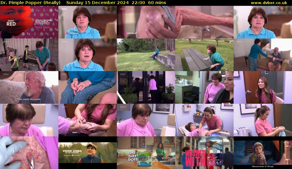 Dr. Pimple Popper (Really) Sunday 15 December 2024 22:00 - 23:00