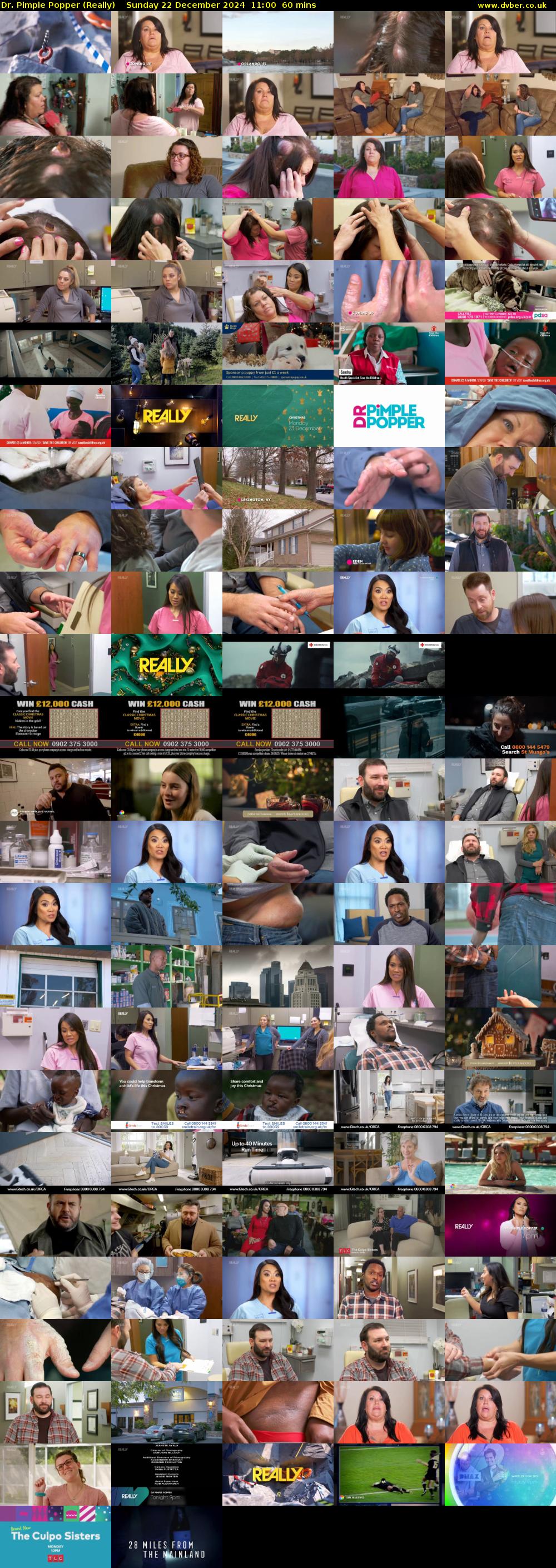 Dr. Pimple Popper (Really) Sunday 22 December 2024 11:00 - 12:00
