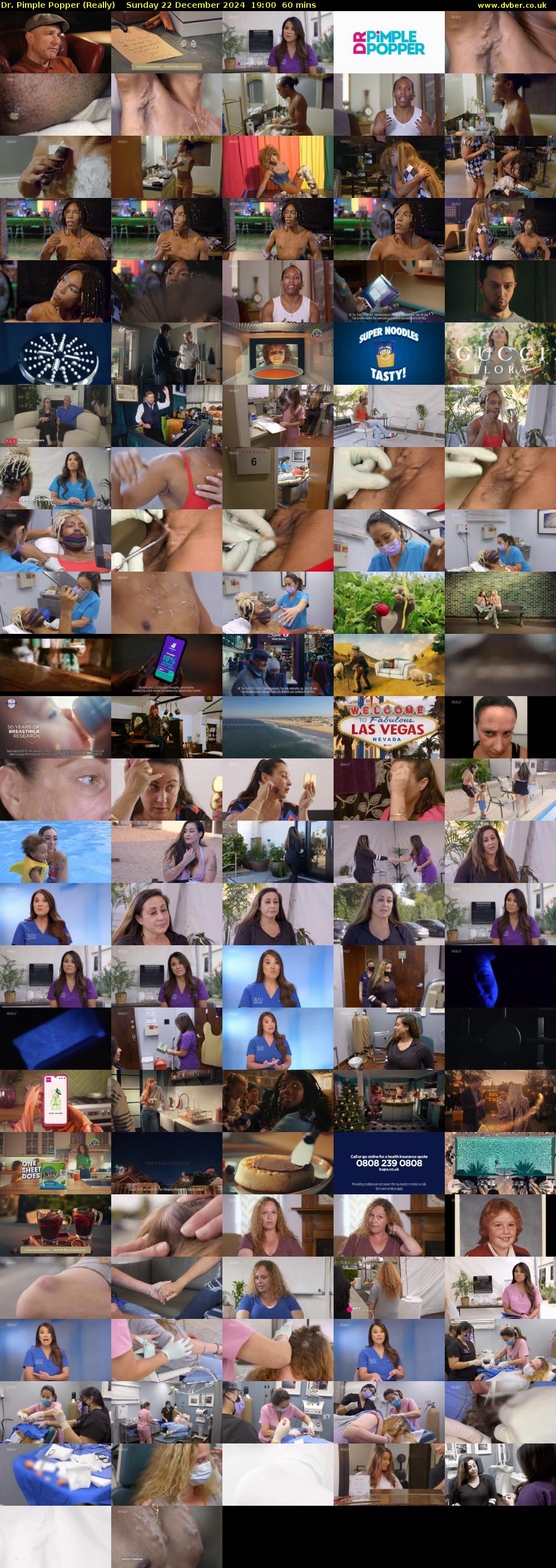 Dr. Pimple Popper (Really) Sunday 22 December 2024 19:00 - 20:00