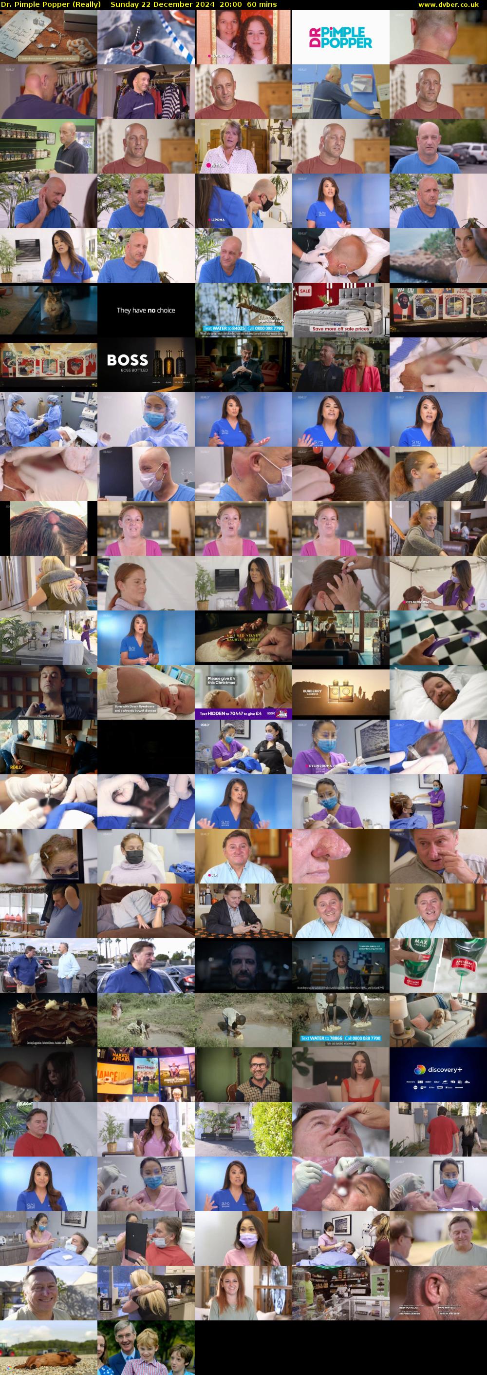 Dr. Pimple Popper (Really) Sunday 22 December 2024 20:00 - 21:00