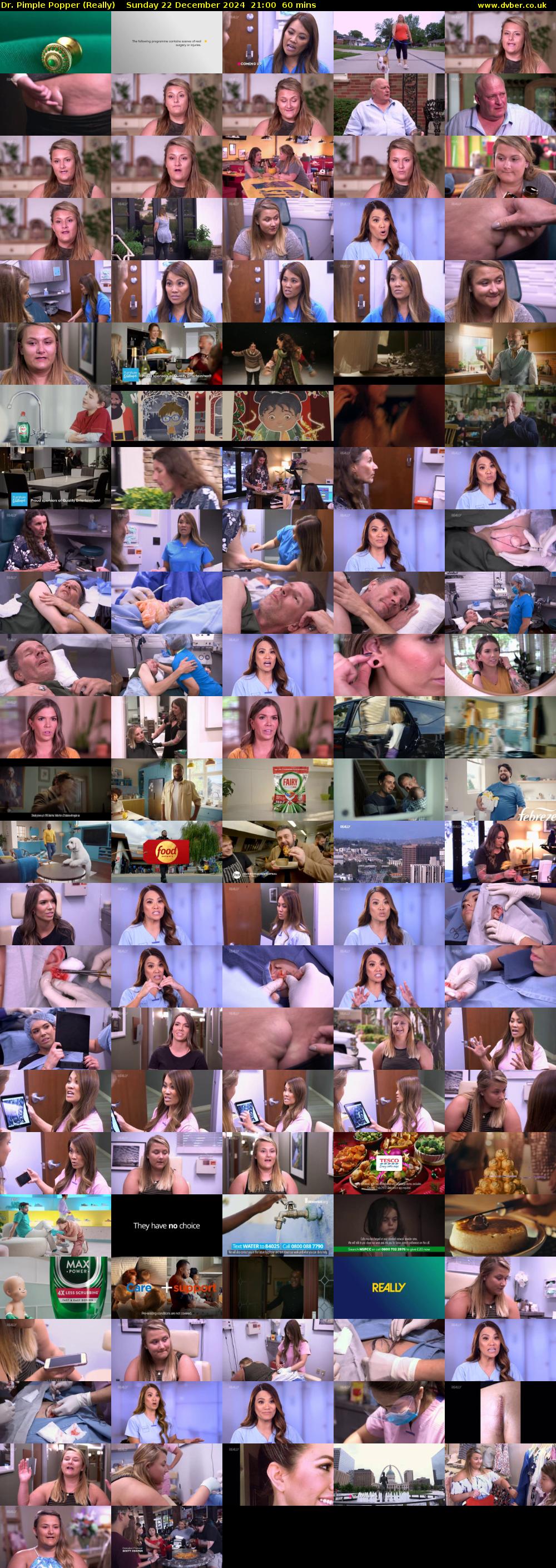 Dr. Pimple Popper (Really) Sunday 22 December 2024 21:00 - 22:00