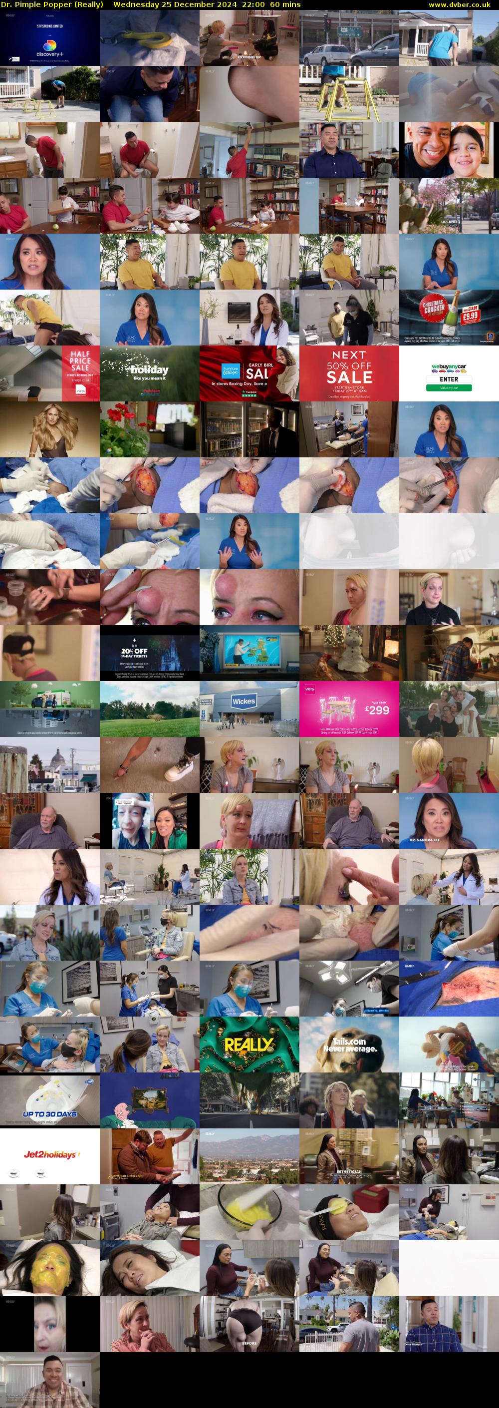 Dr. Pimple Popper (Really) Wednesday 25 December 2024 22:00 - 23:00