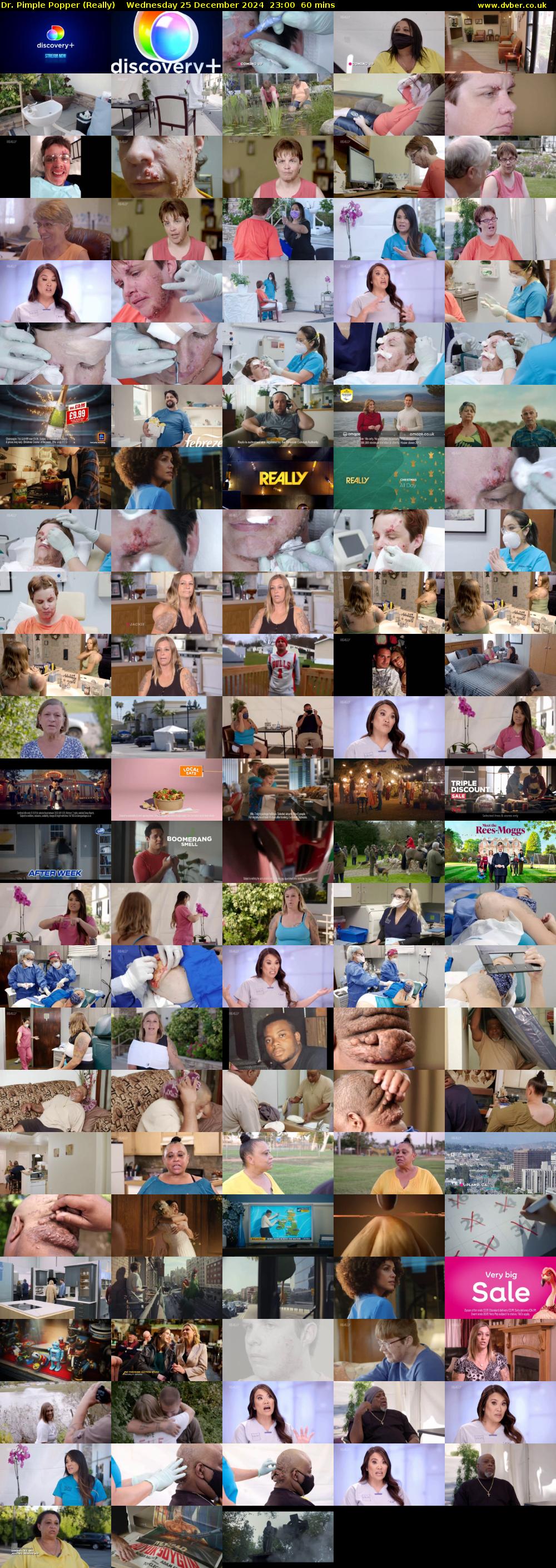 Dr. Pimple Popper (Really) Wednesday 25 December 2024 23:00 - 00:00