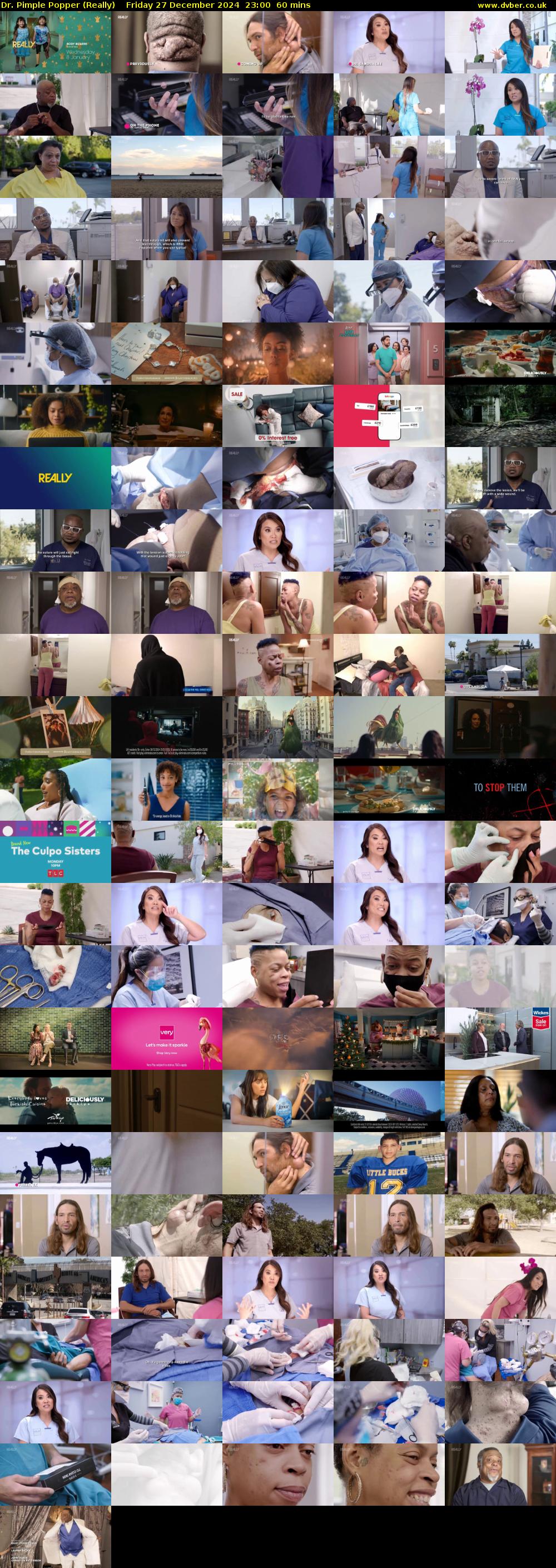 Dr. Pimple Popper (Really) Friday 27 December 2024 23:00 - 00:00