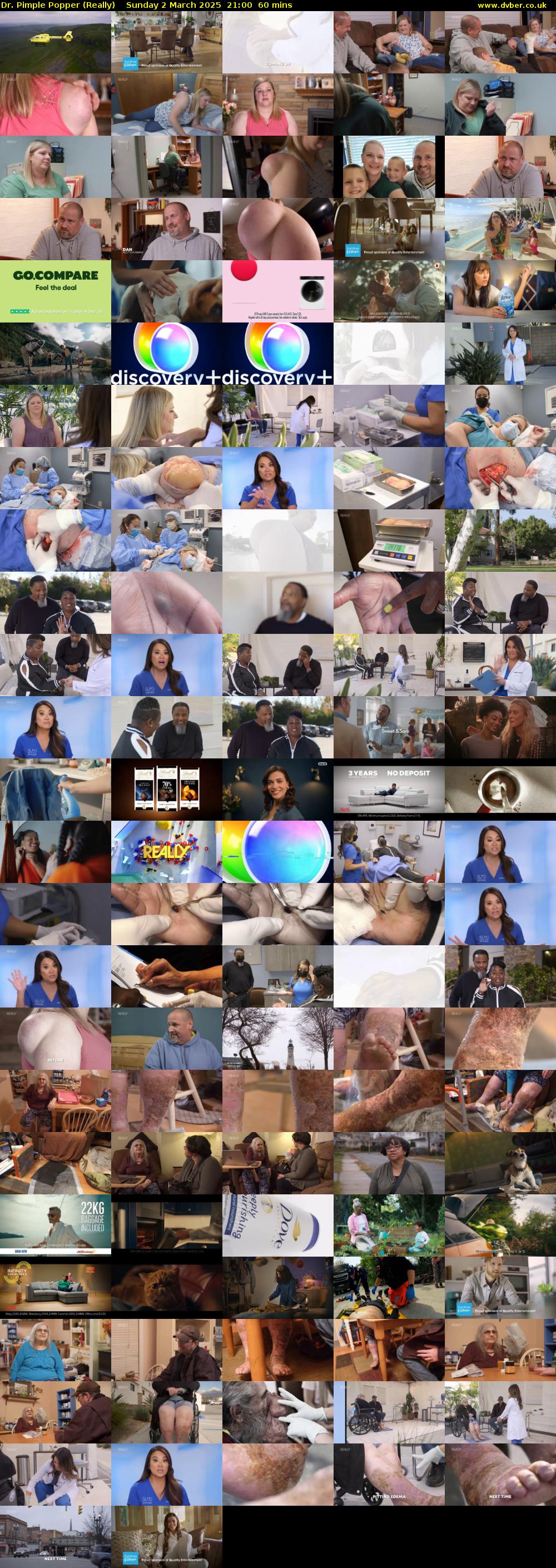 Dr. Pimple Popper (Really) Sunday 2 March 2025 21:00 - 22:00