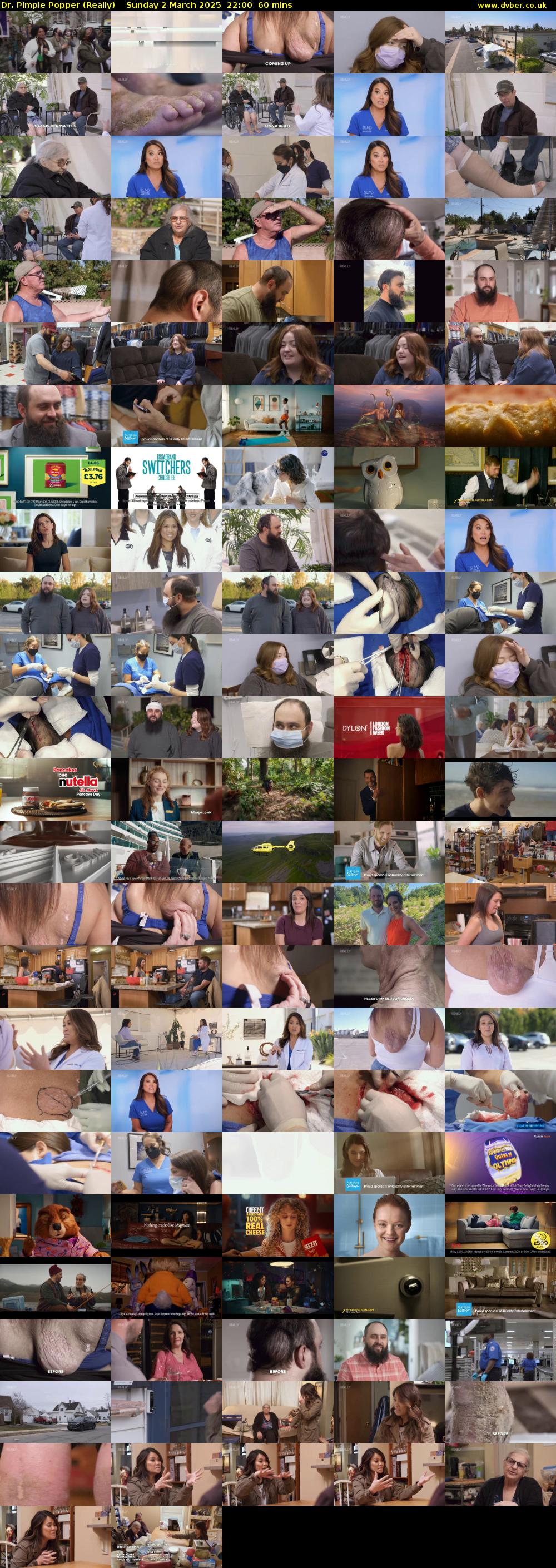 Dr. Pimple Popper (Really) Sunday 2 March 2025 22:00 - 23:00