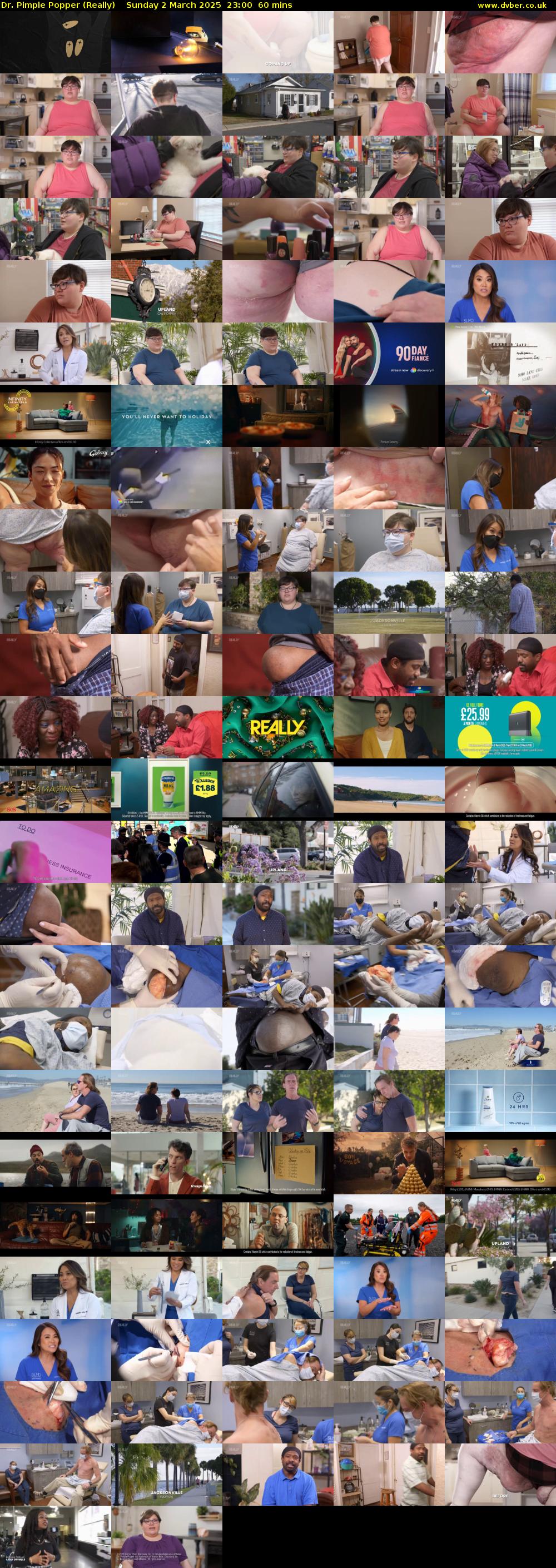 Dr. Pimple Popper (Really) Sunday 2 March 2025 23:00 - 00:00