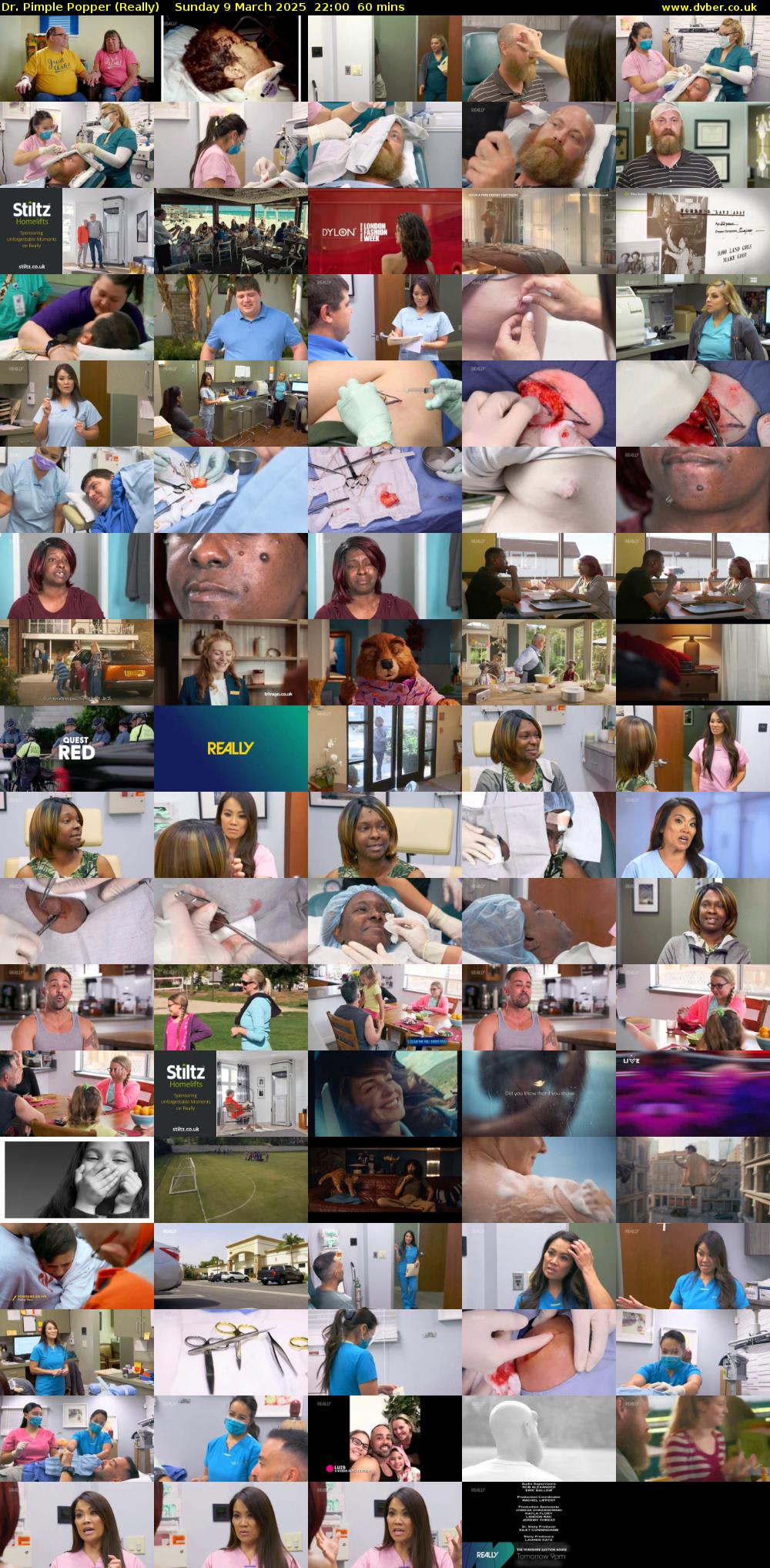 Dr. Pimple Popper (Really) Sunday 9 March 2025 22:00 - 23:00