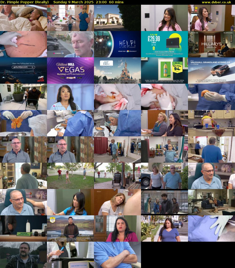 Dr. Pimple Popper (Really) Sunday 9 March 2025 23:00 - 00:00