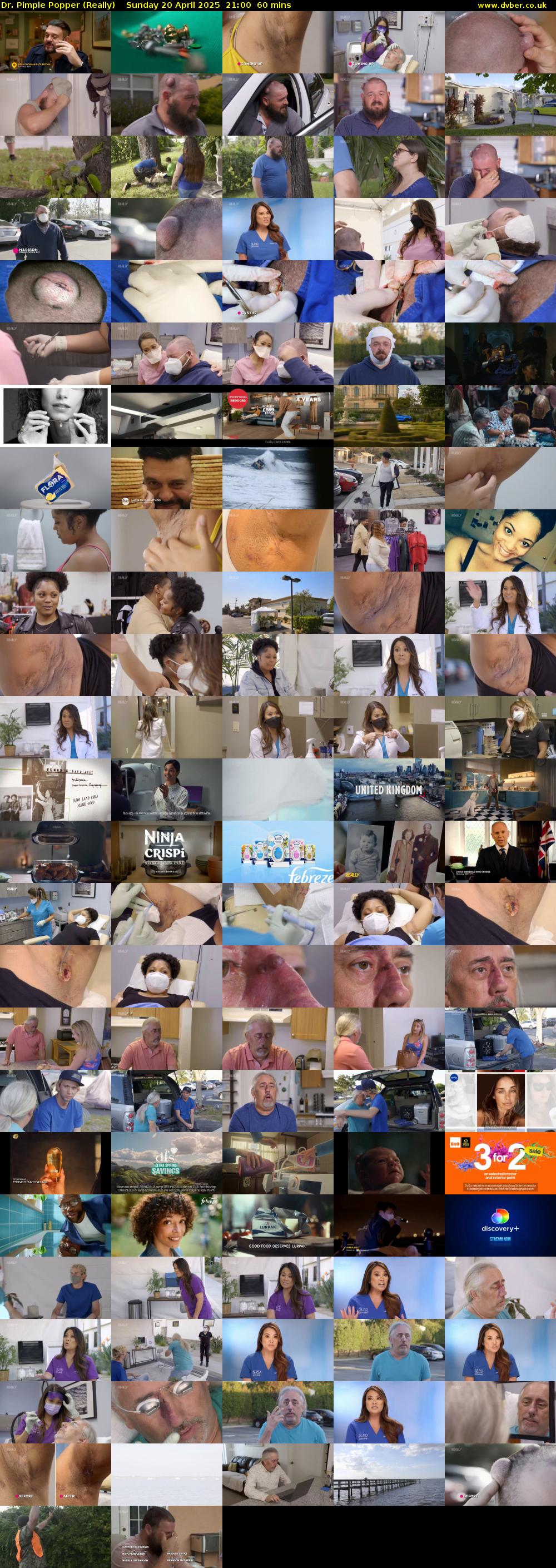 Dr. Pimple Popper (Really) Sunday 20 April 2025 21:00 - 22:00
