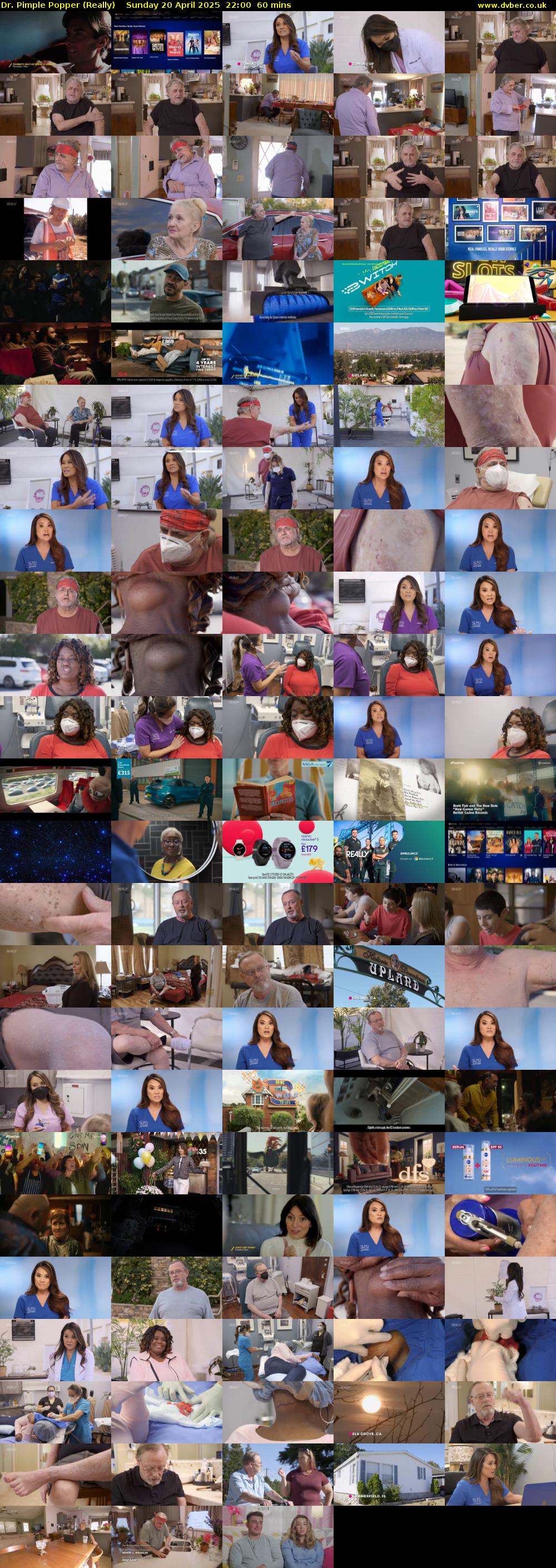 Dr. Pimple Popper (Really) Sunday 20 April 2025 22:00 - 23:00