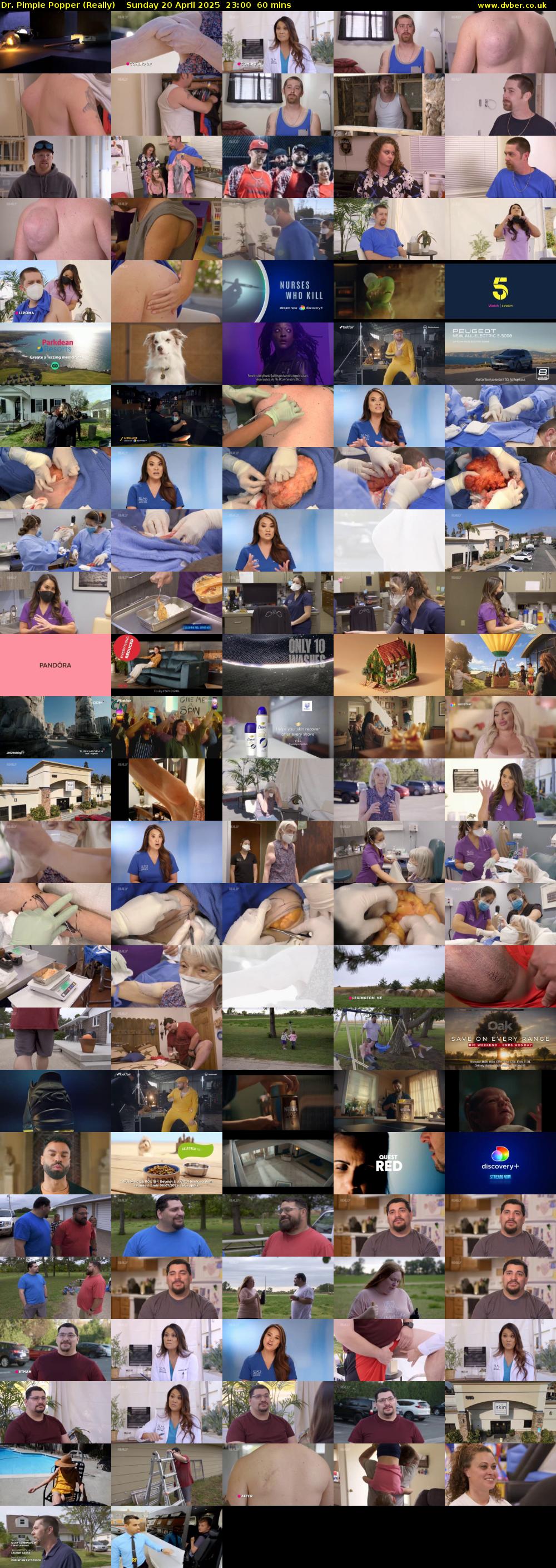 Dr. Pimple Popper (Really) Sunday 20 April 2025 23:00 - 00:00
